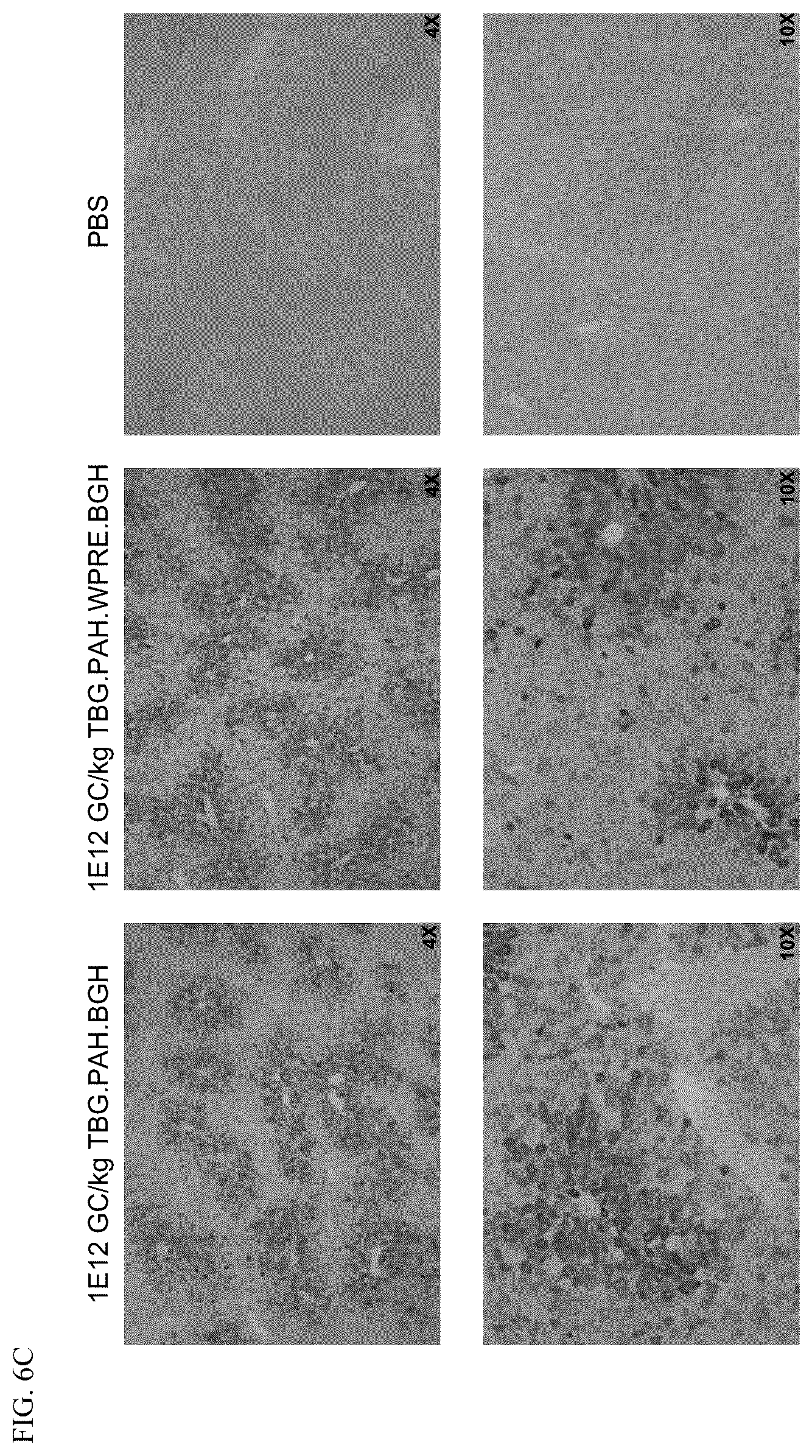 Patent US12569525 Figure 9 – Gene therapy for treating phenylketonuria