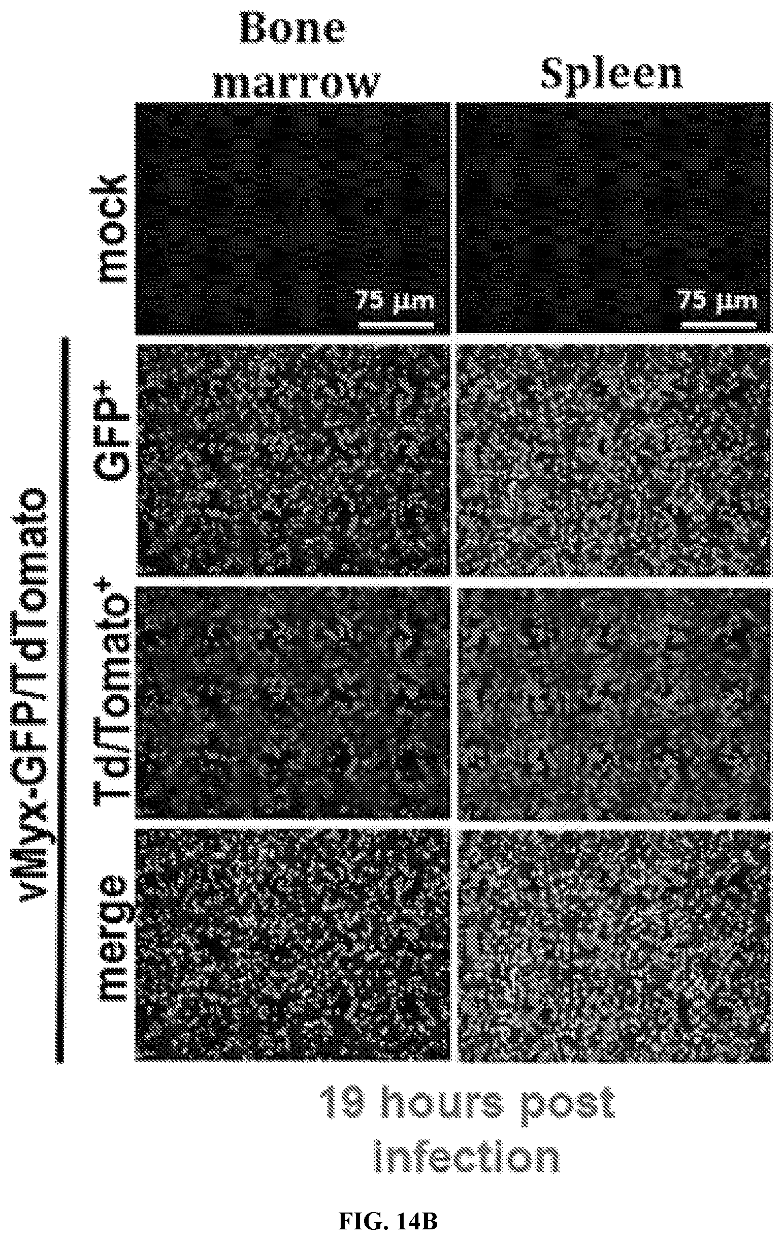 Patent US12569526 Figure 17 – Oncolytic virus platform to treat hematological cancer