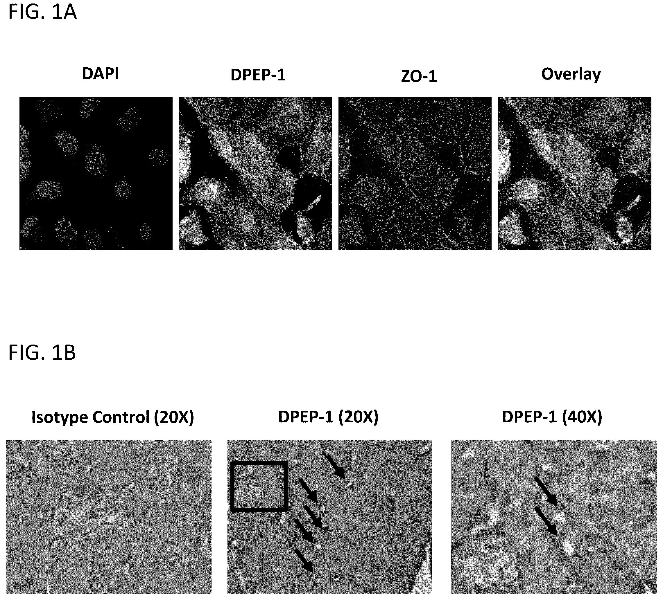 Patent US12569538 Figure 1 – DPEP-1 binding compositions and methods of use