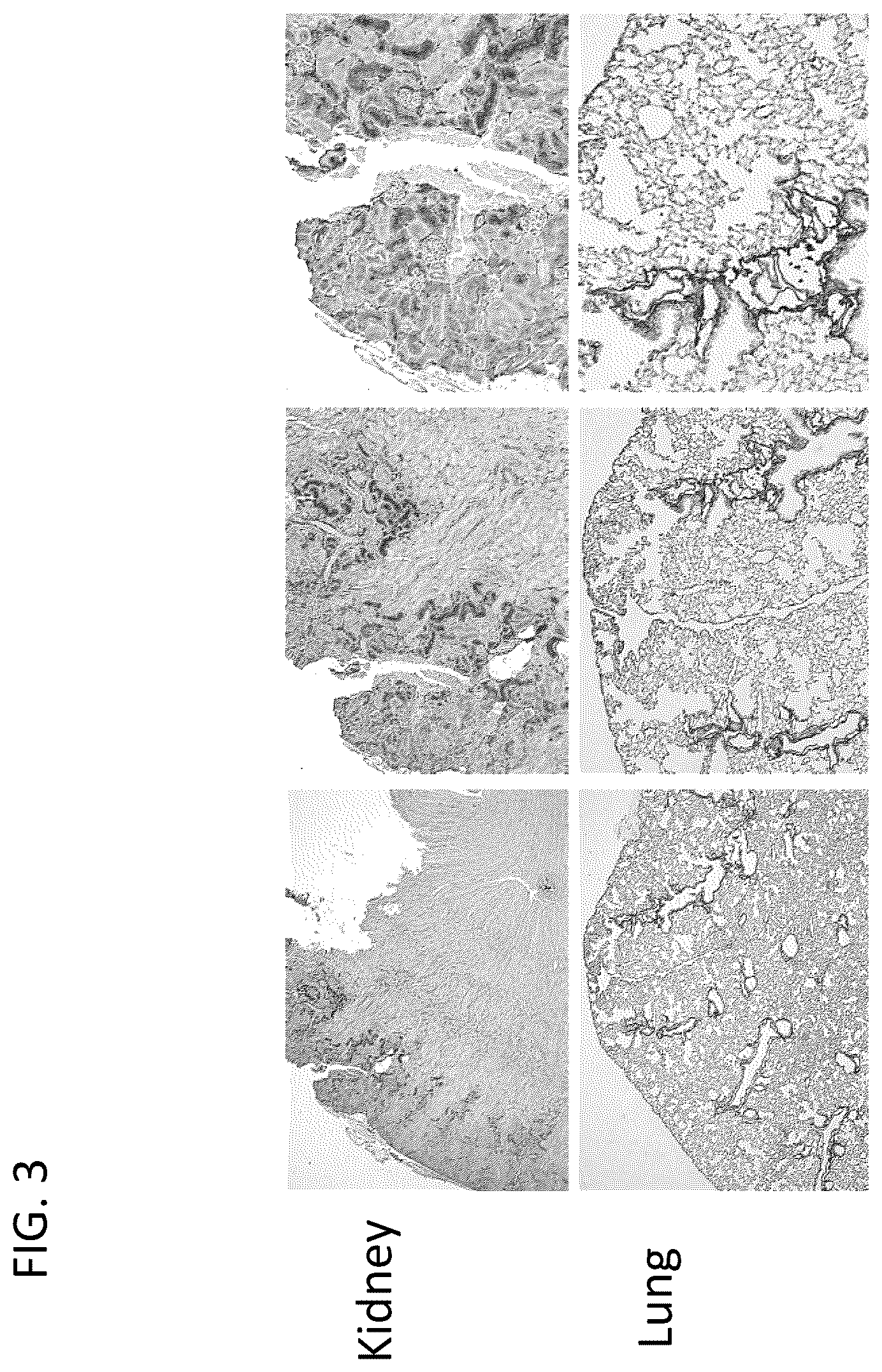 Patent US12569538 Figure 4 – DPEP-1 binding compositions and methods of use