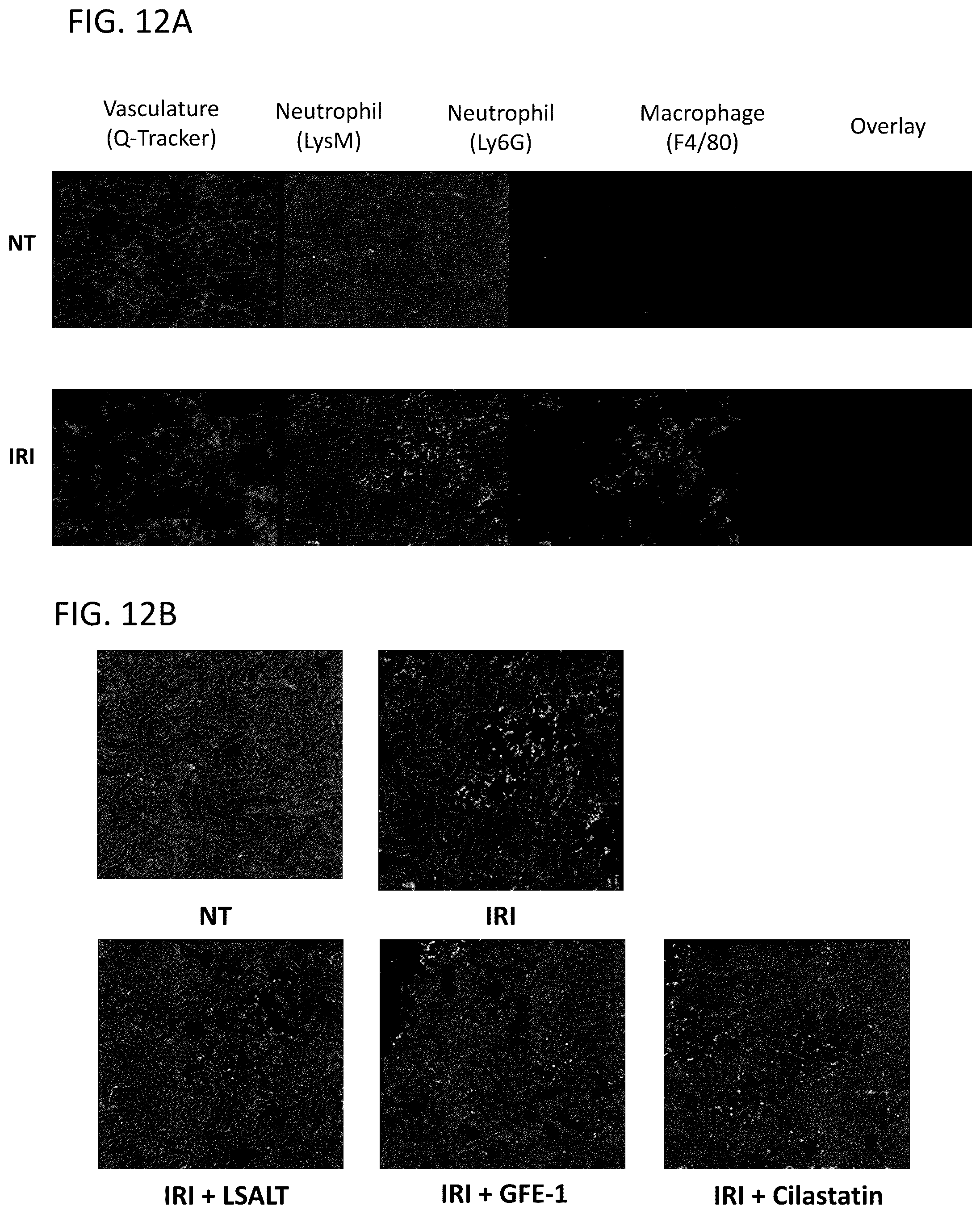 Patent US12569538 Figure 16 – DPEP-1 binding compositions and methods of use