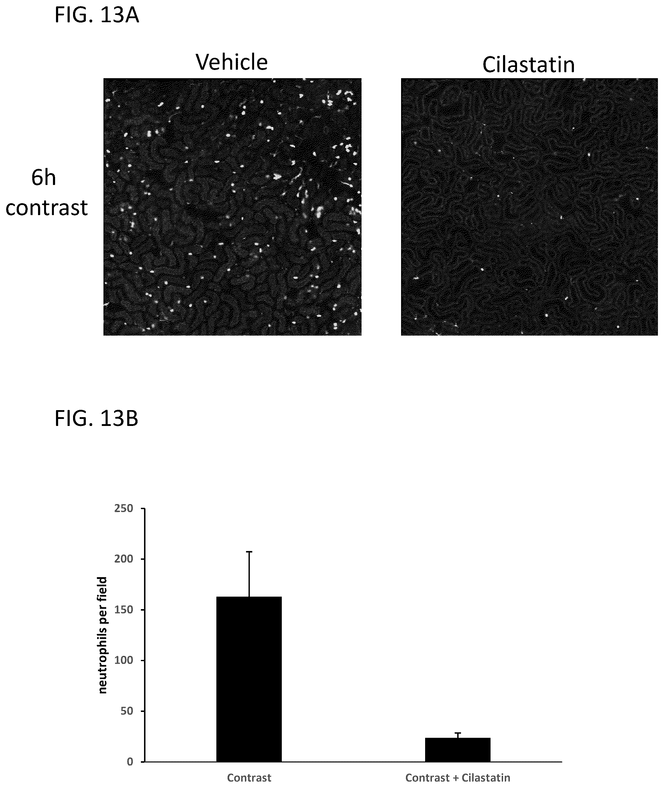 Patent US12569538 Figure 18 – DPEP-1 binding compositions and methods of use