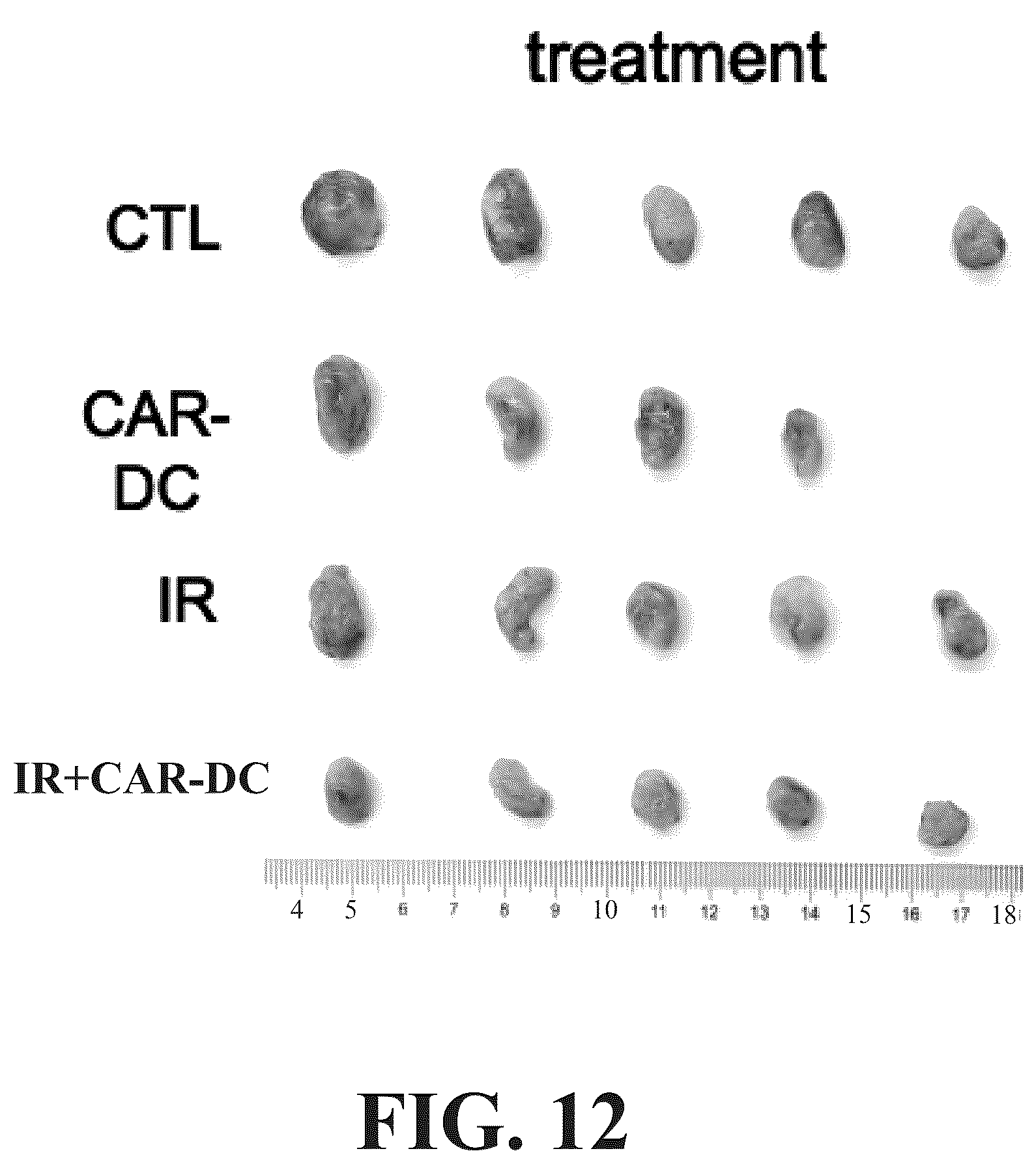 Patent US12569559 Figure 13 – Engineered dendritic cell and use thereof