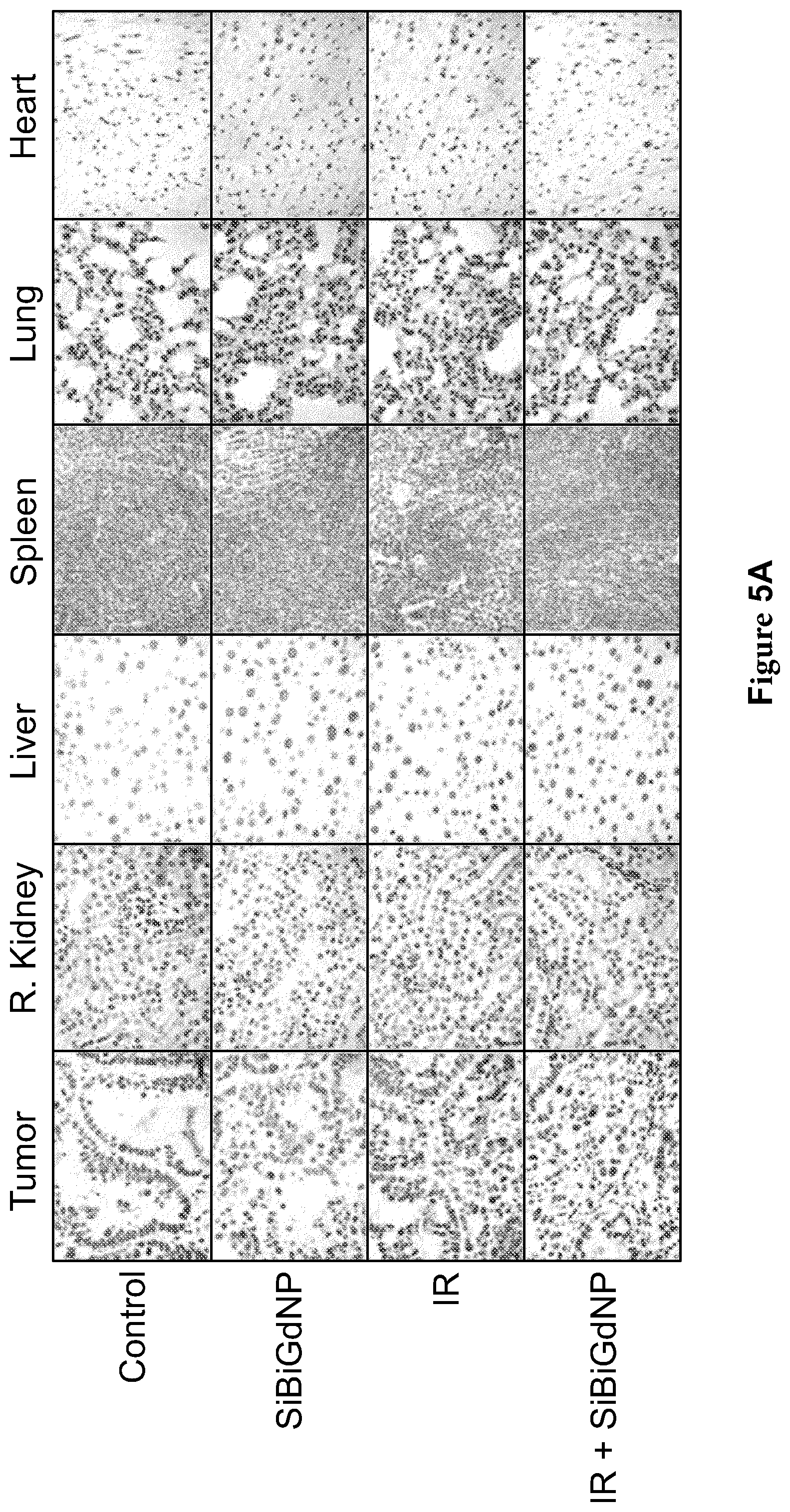 Patent US12569560 Figure 12 – Bismuth-gadolinium nanoparticles