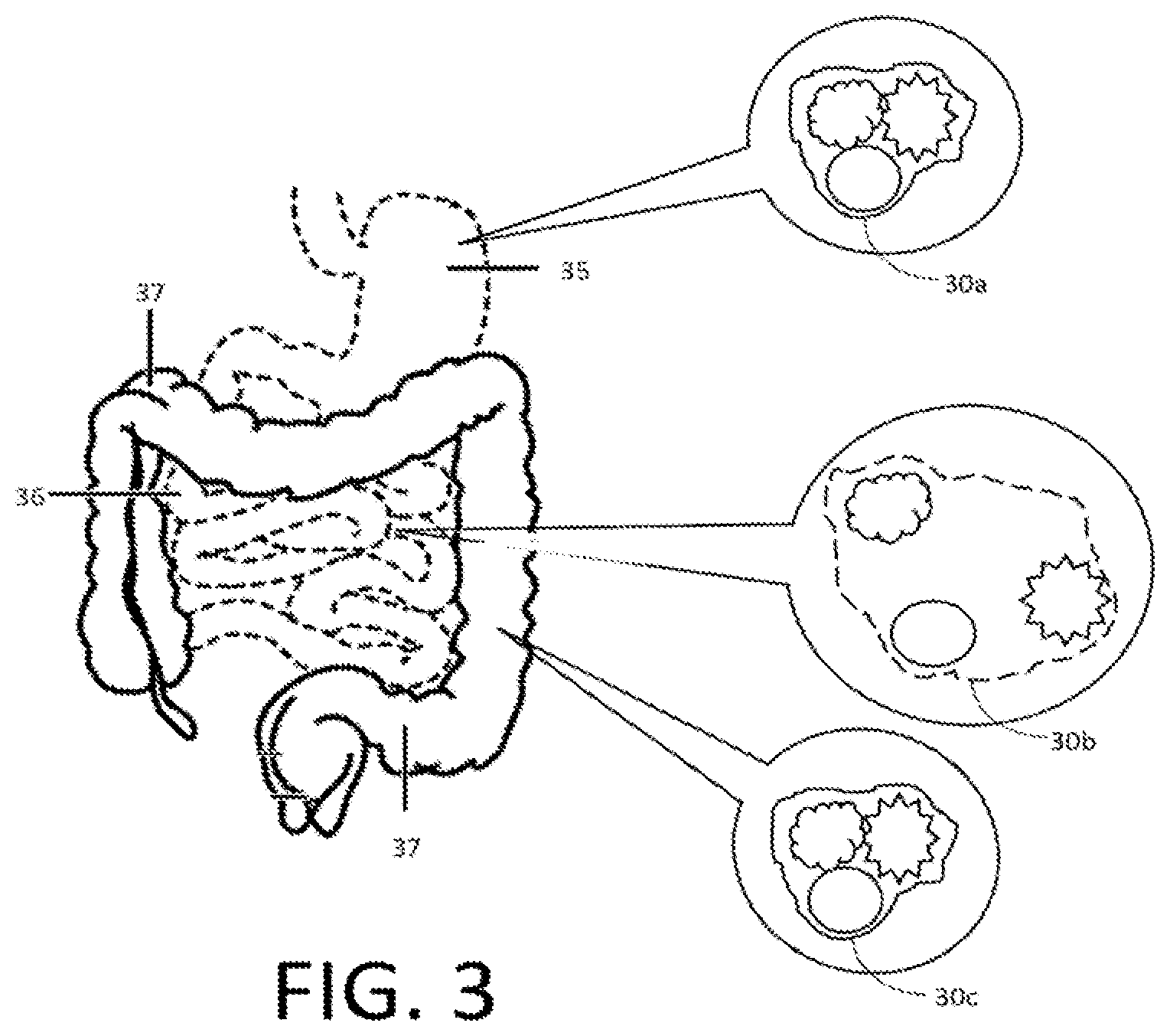 Patent US12569571 Figure 3 – Salt responsive nanogels and nanoparticles