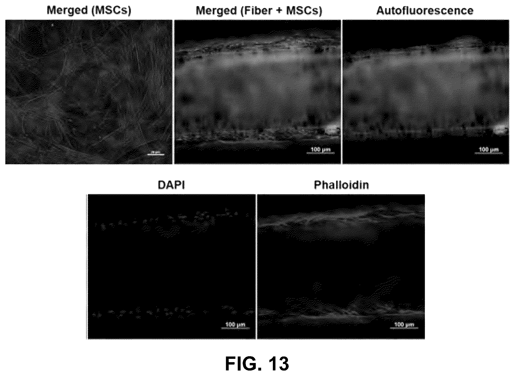 Patent US12569591 Figure 14 – Mxene-aromatic thermosetting copolyester nanocomposite as an extremely wear-resistant biocompatible implant material for osteoarthritis applications