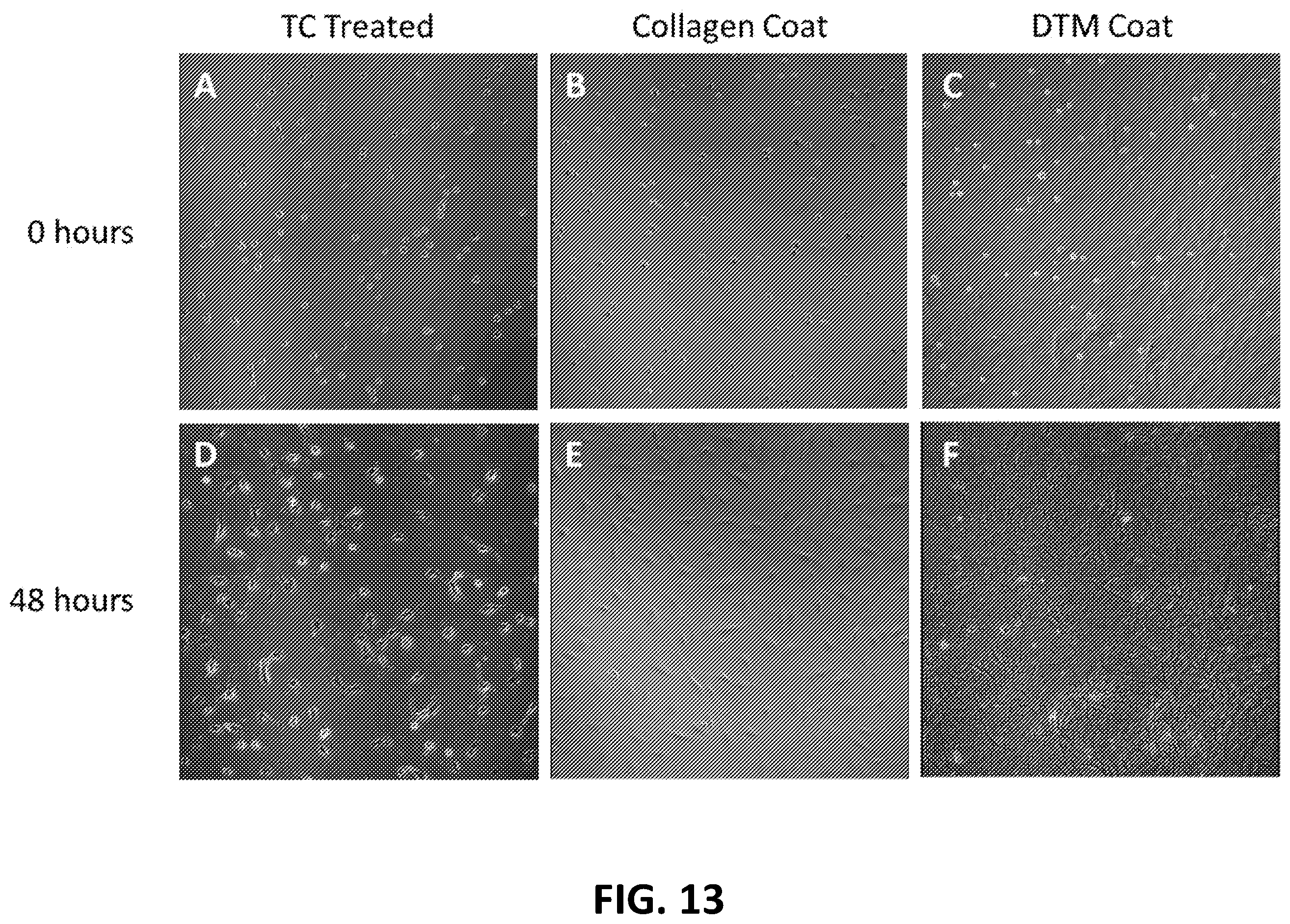 Patent US12569594 Figure 17 – Decellularized tendon matrix methods and uses thereof