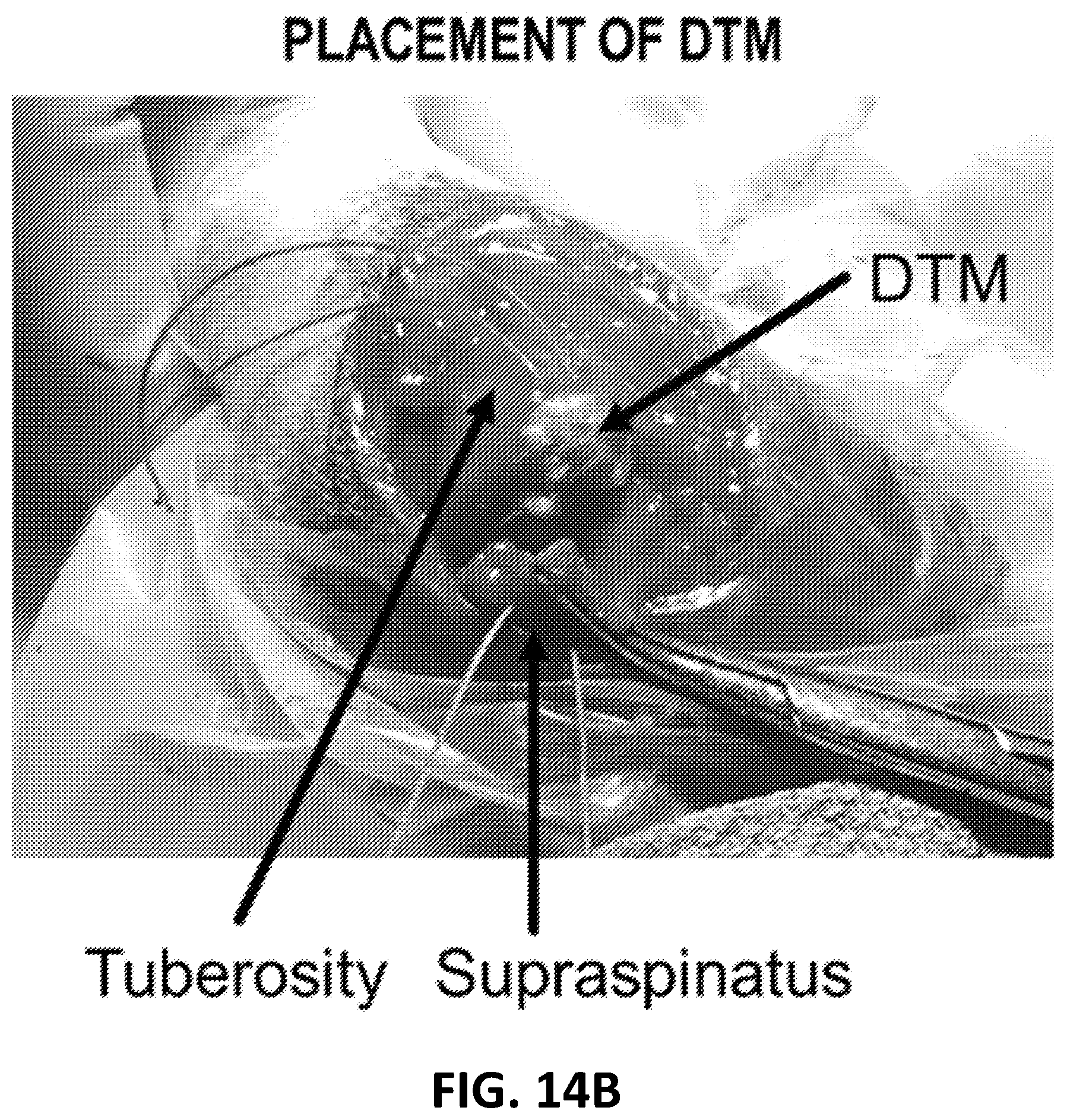 Patent US12569594 Figure 19 – Decellularized tendon matrix methods and uses thereof
