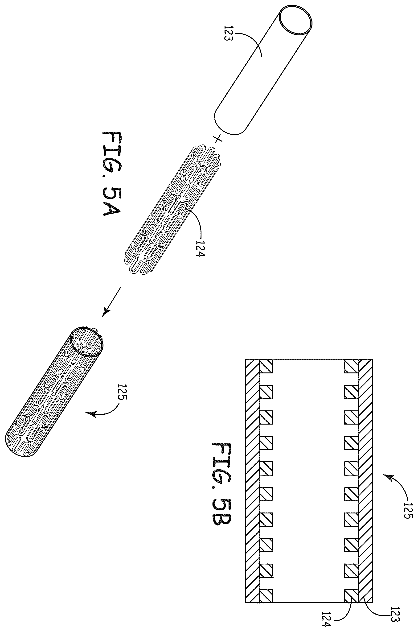 Patent US12569597 Figure 5 – Methods for forming stents modified with material comprising amnion tissue