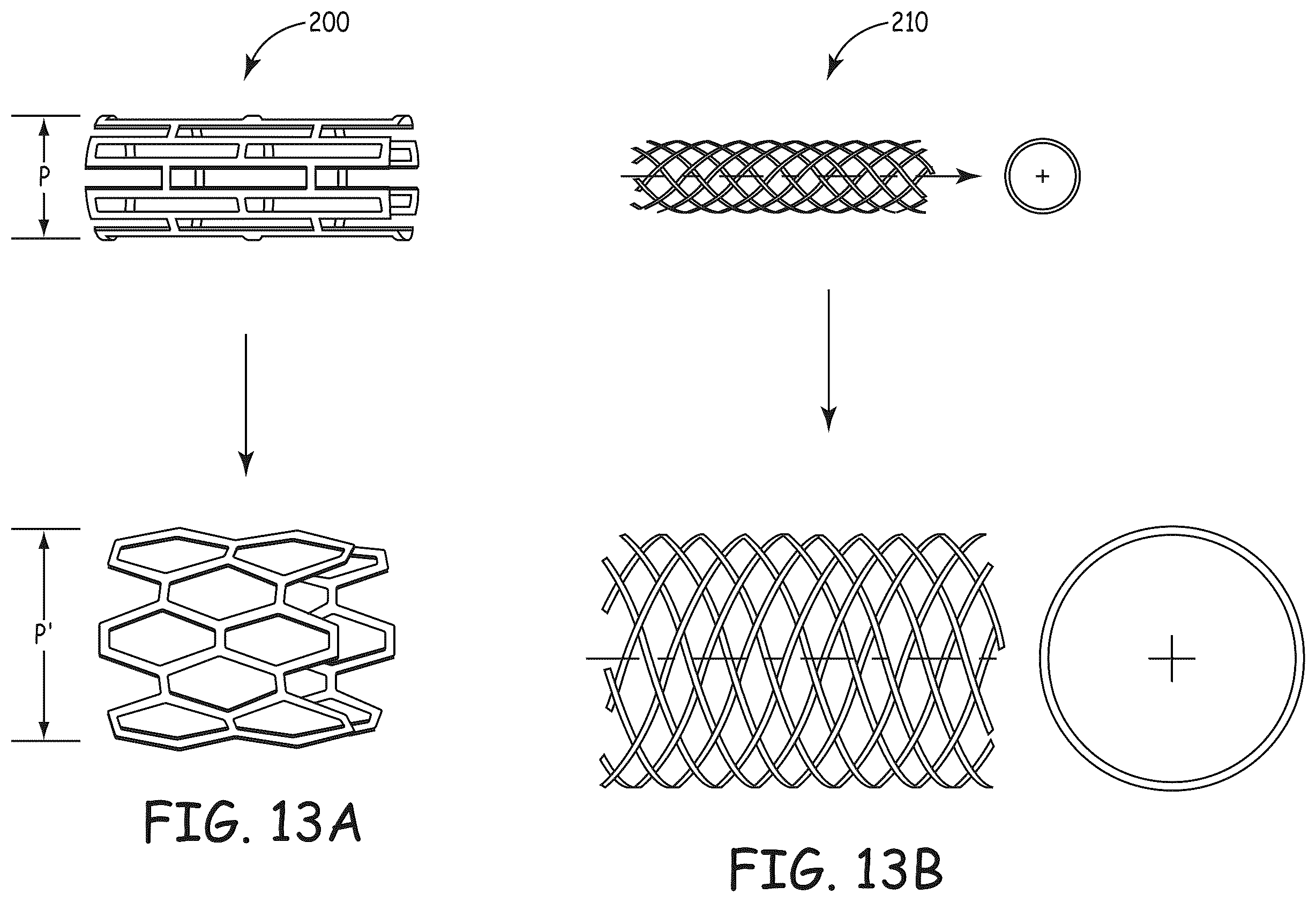 Patent US12569597 Figure 13 – Methods for forming stents modified with material comprising amnion tissue
