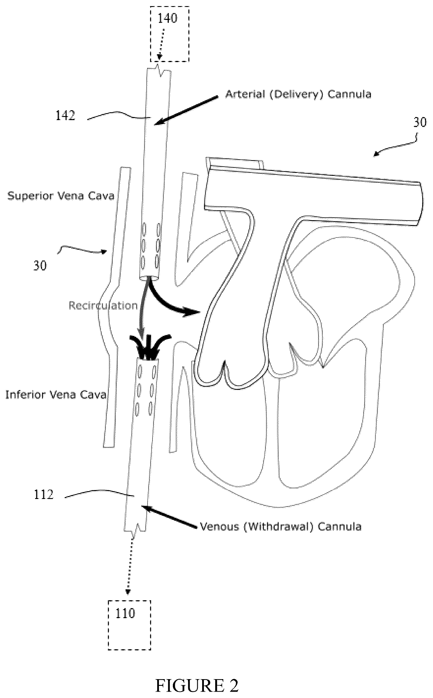 Patent US12569600 Figure 2 – Method and apparatus for assessing cardiac output in veno-venous extracorporeal blood oxygenation