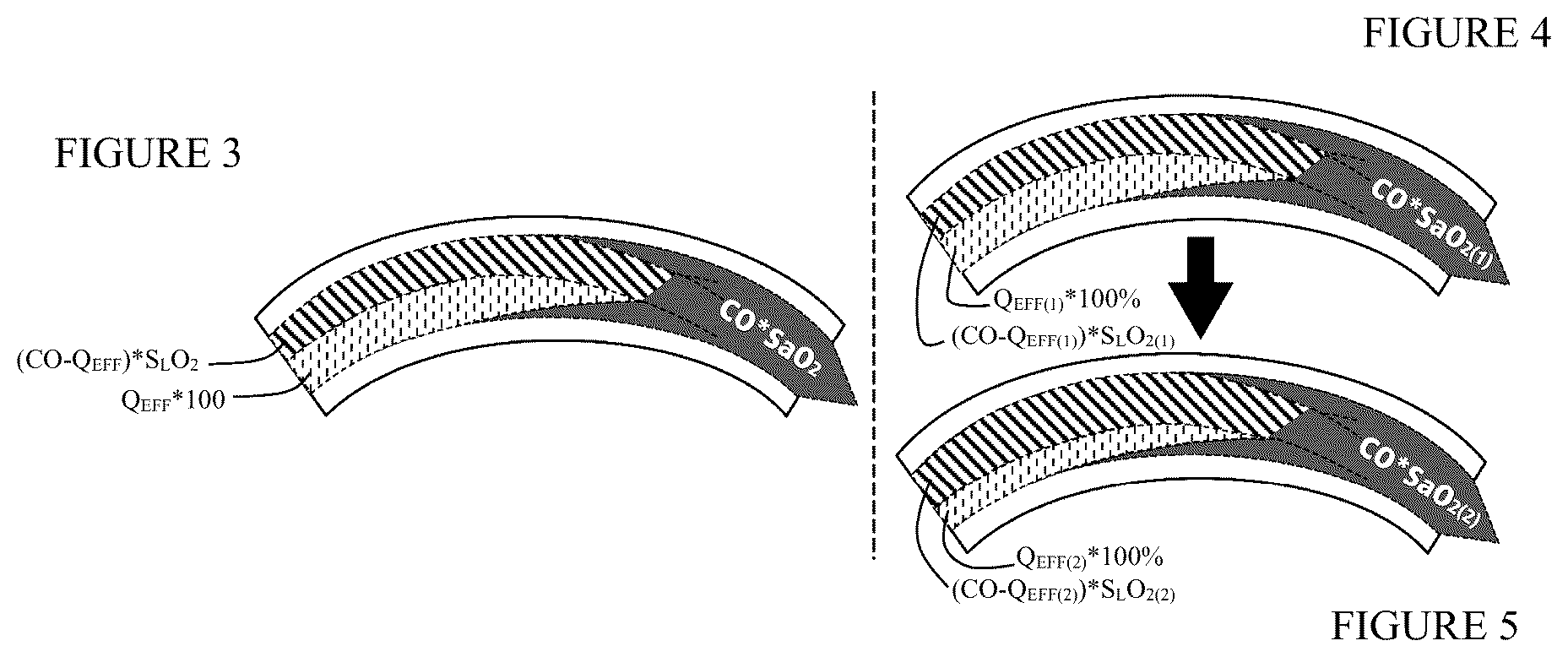 Patent US12569600 Figure 3 – Method and apparatus for assessing cardiac output in veno-venous extracorporeal blood oxygenation