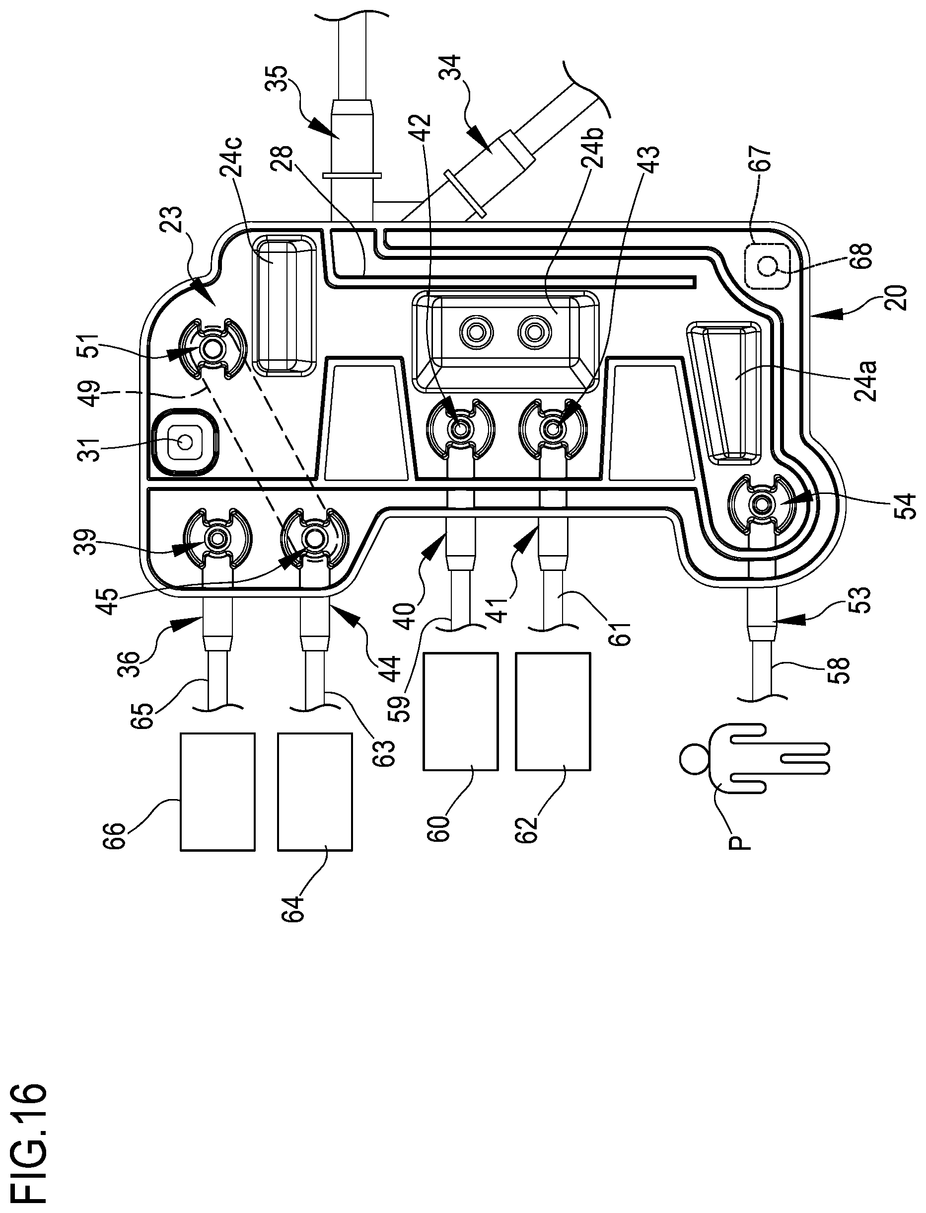 Patent US12569603 Figure 13 – Method for calibrating a peristaltic pump in a medical apparatus and medical apparatus for performing this method