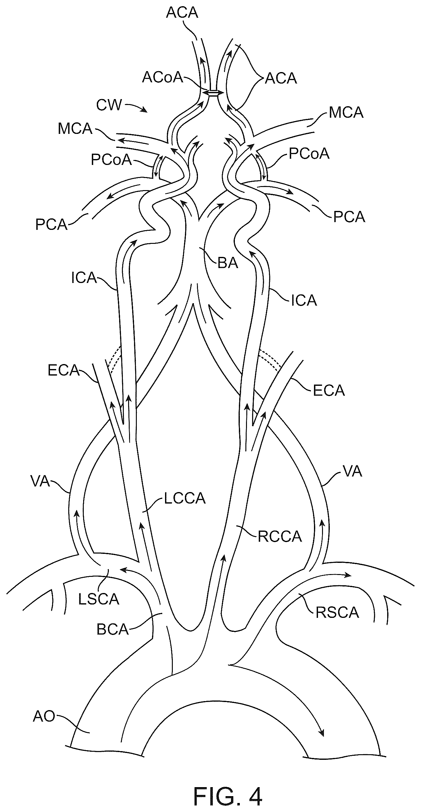 Patent US12569607 Figure 8 – Embolic protection in connection with transcarotid carotid artery revascularization
