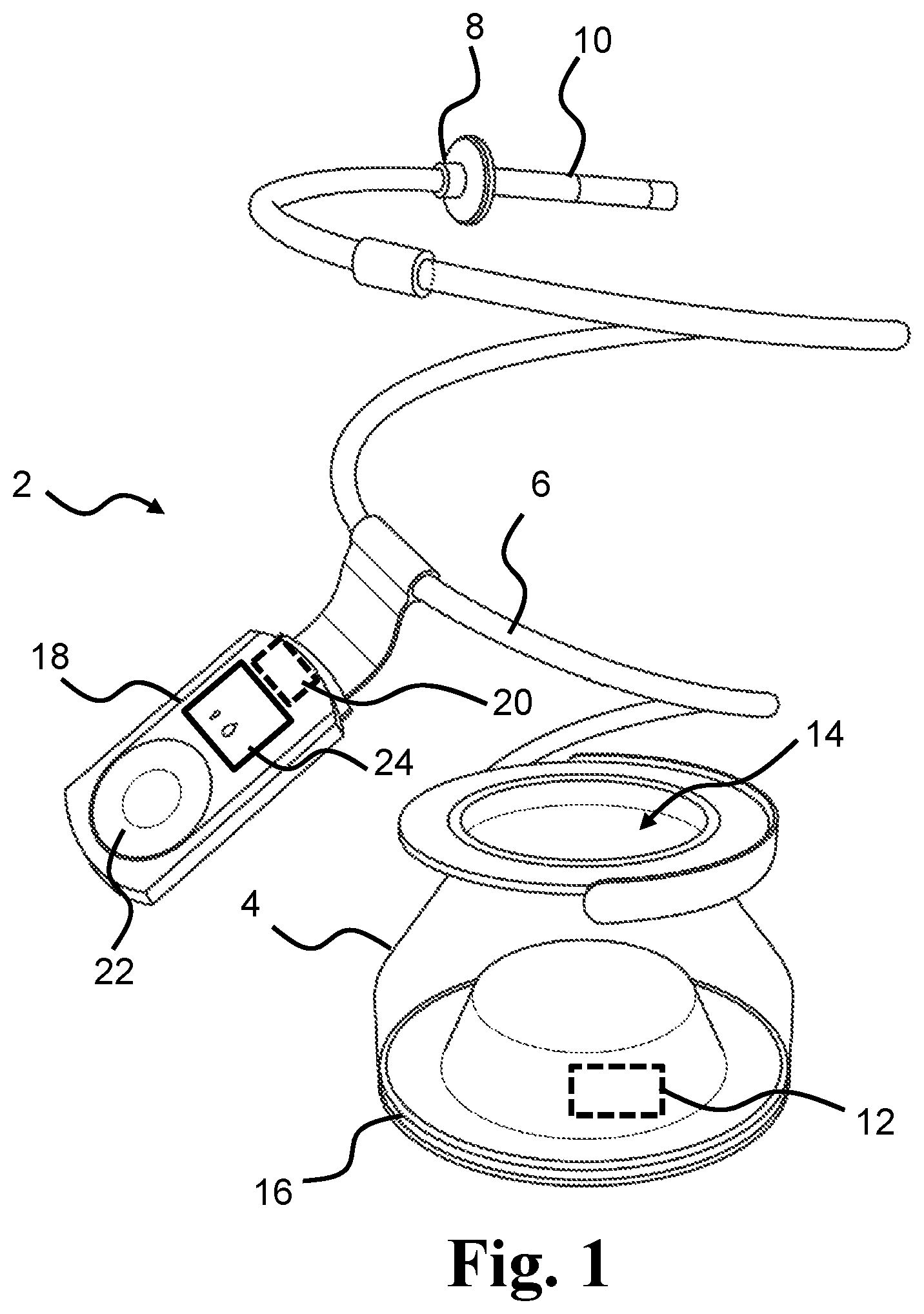 Patent US12569612 Figure 1 – Method for disinfecting an anal irrigation system