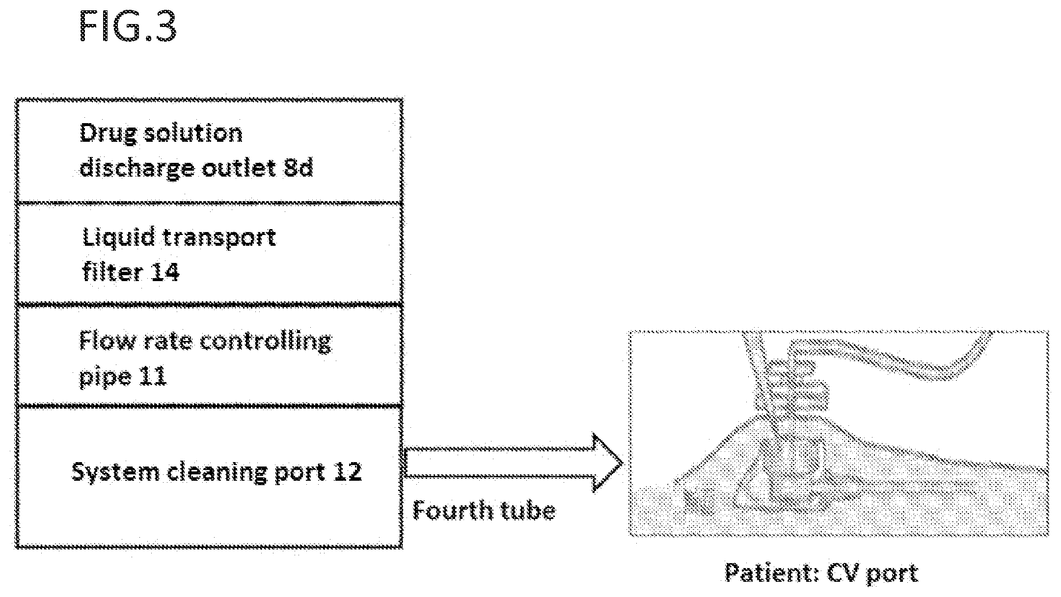 Patent US12569614 Figure 3 – Pressurization-type drug injector having drug exposure preventive function