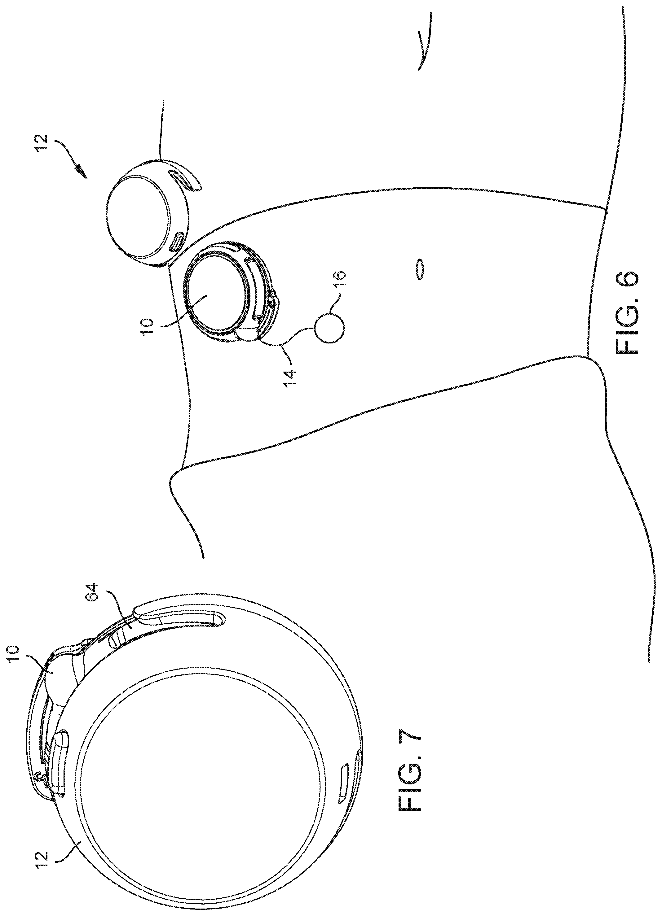 Patent US12569615 Figure 3 – Medical device, method and systems