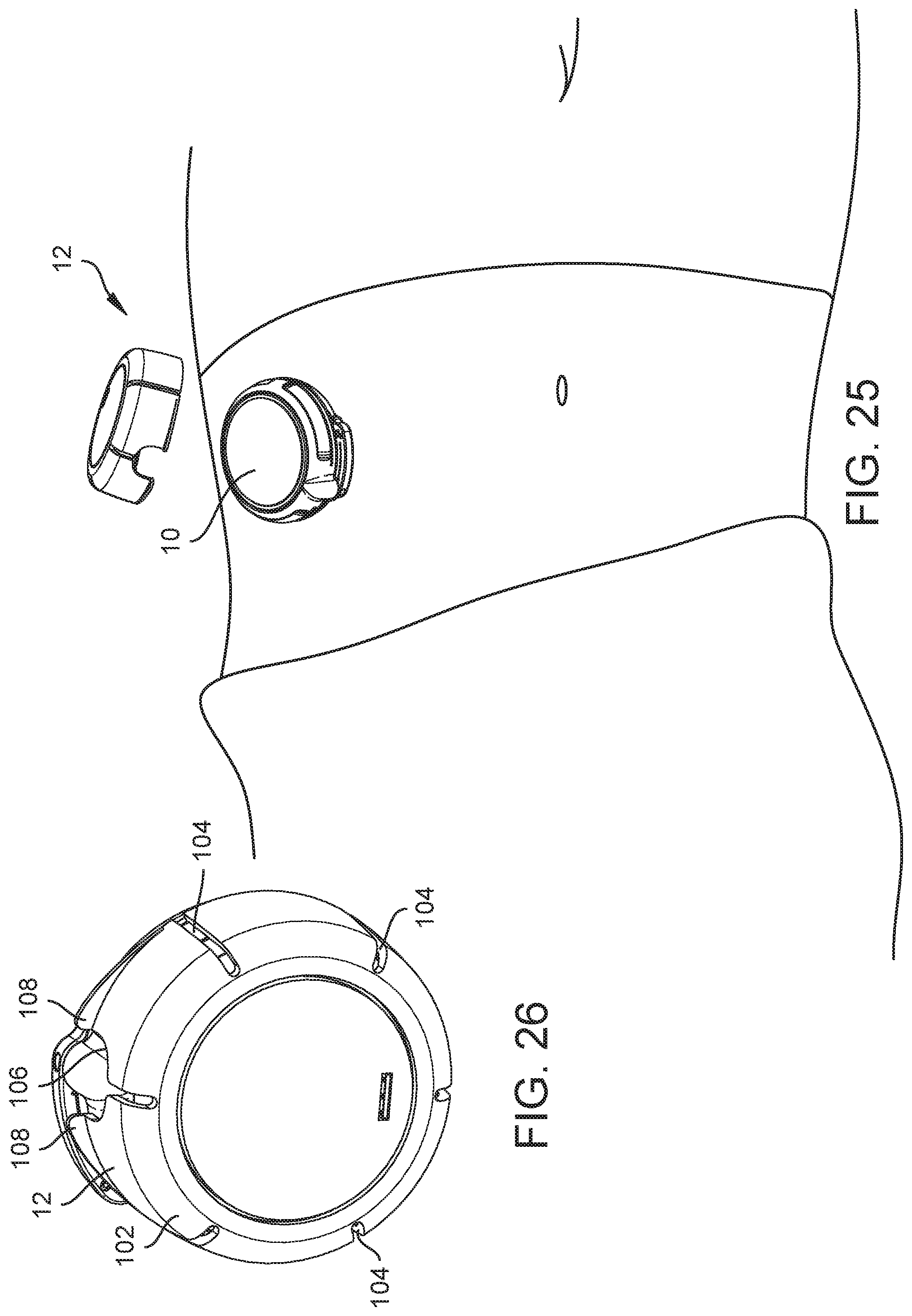 Patent US12569615 Figure 9 – Medical device, method and systems