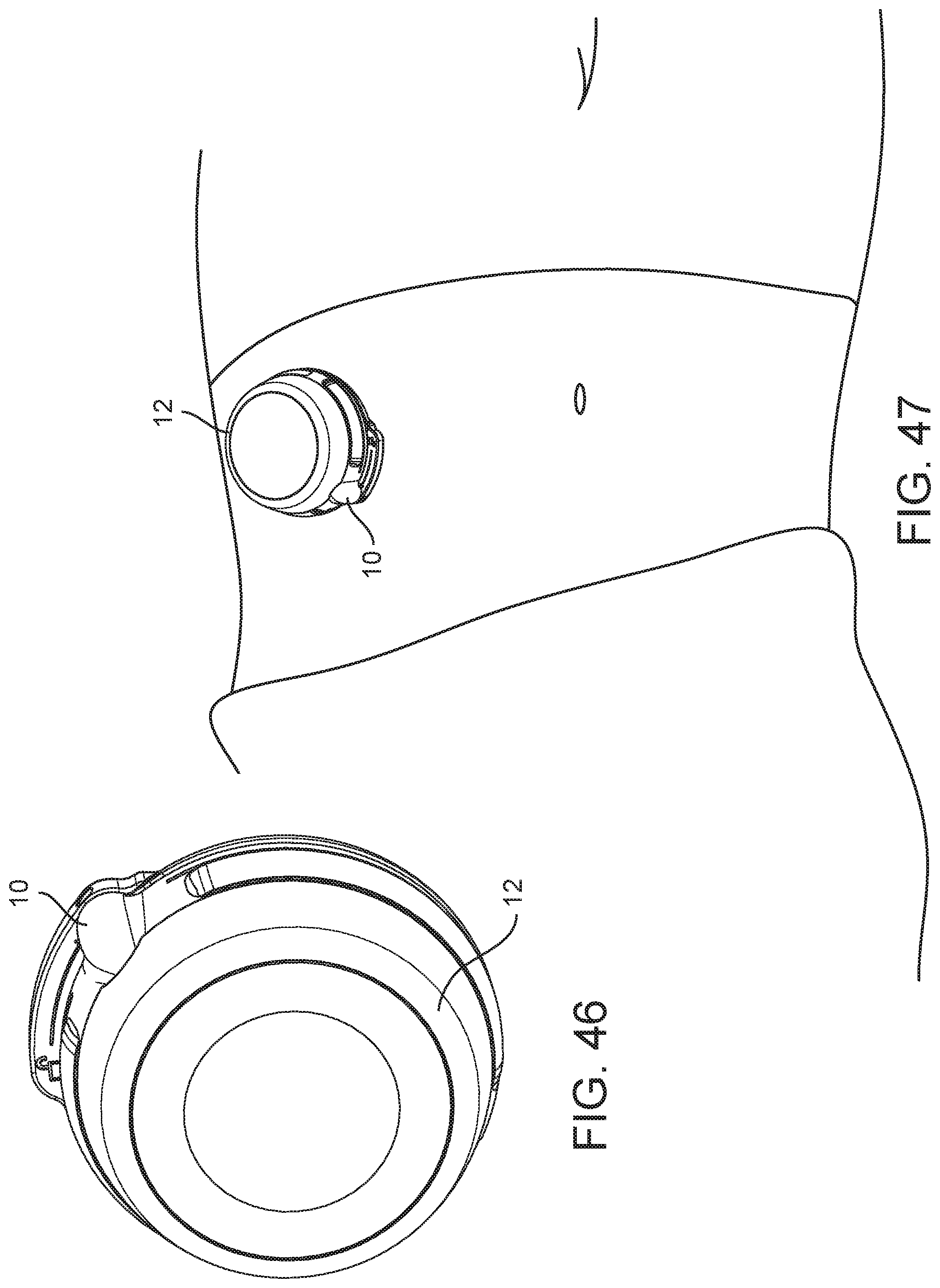 Patent US12569615 Figure 15 – Medical device, method and systems
