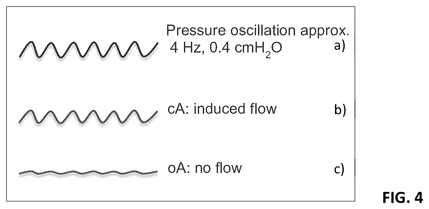 Patent US12569632 Figure 3 – Respirator for APAP respiration using oscillatory pressure