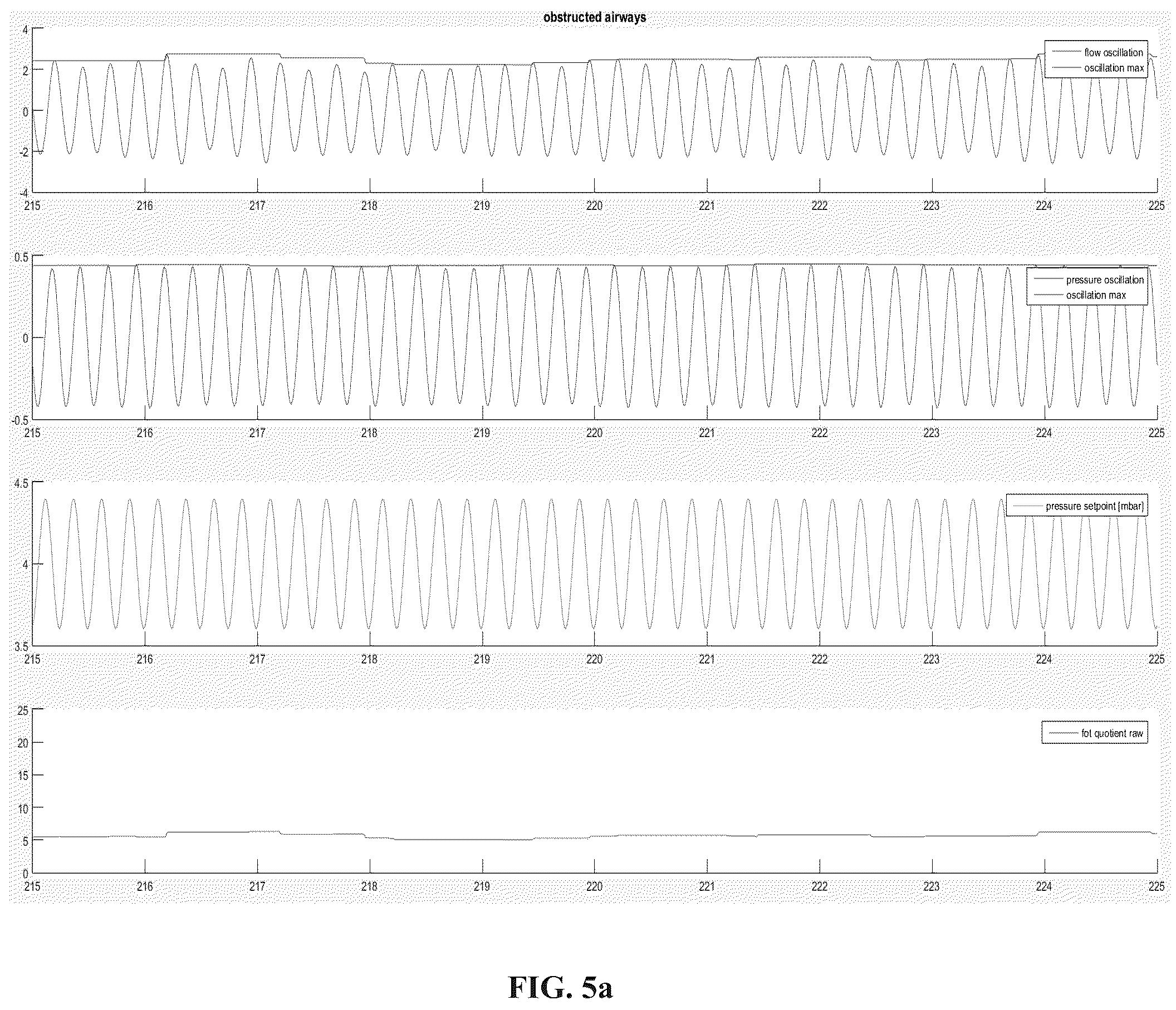 Patent US12569632 Figure 4 – Respirator for APAP respiration using oscillatory pressure