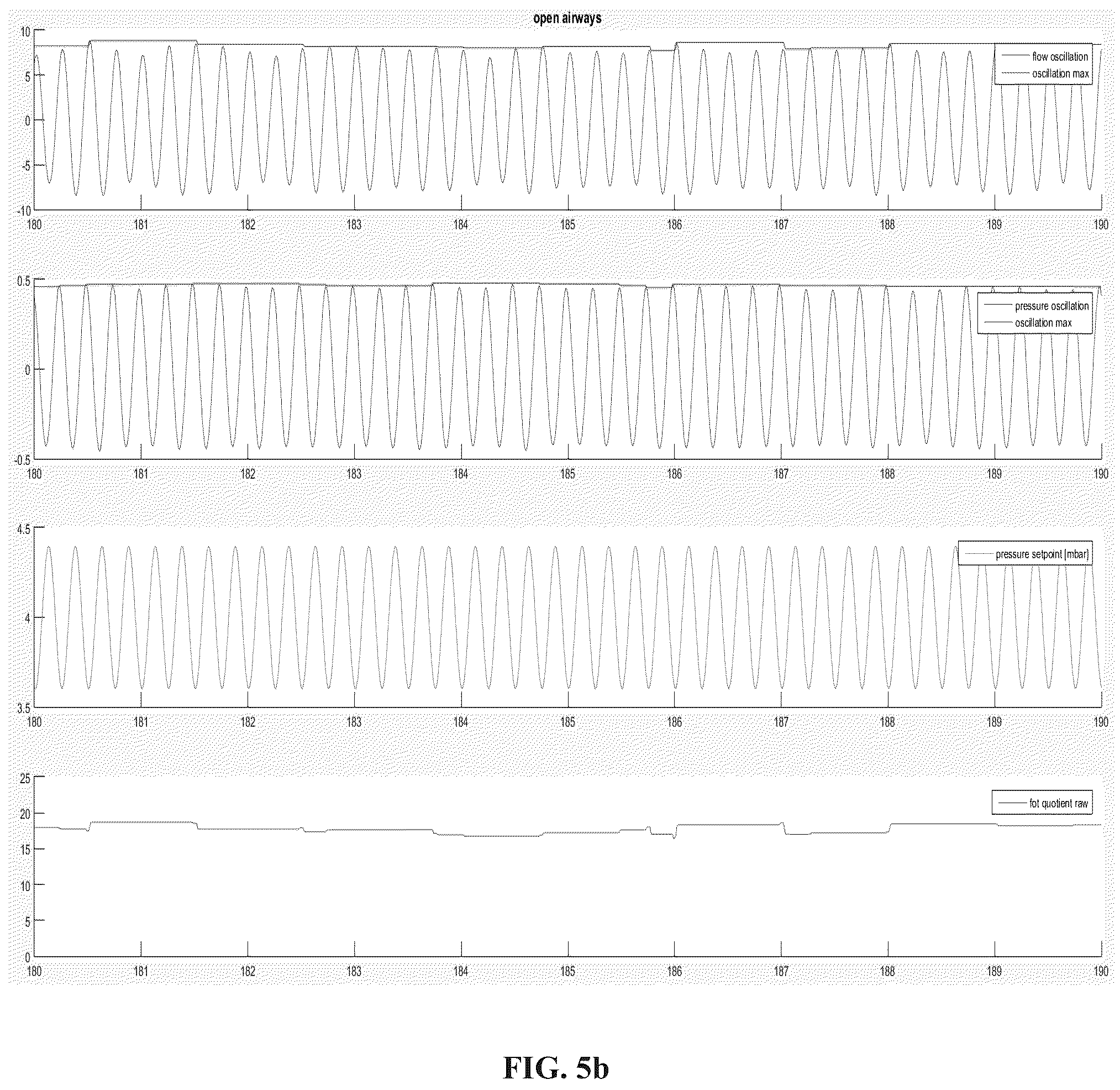 Patent US12569632 Figure 5 – Respirator for APAP respiration using oscillatory pressure