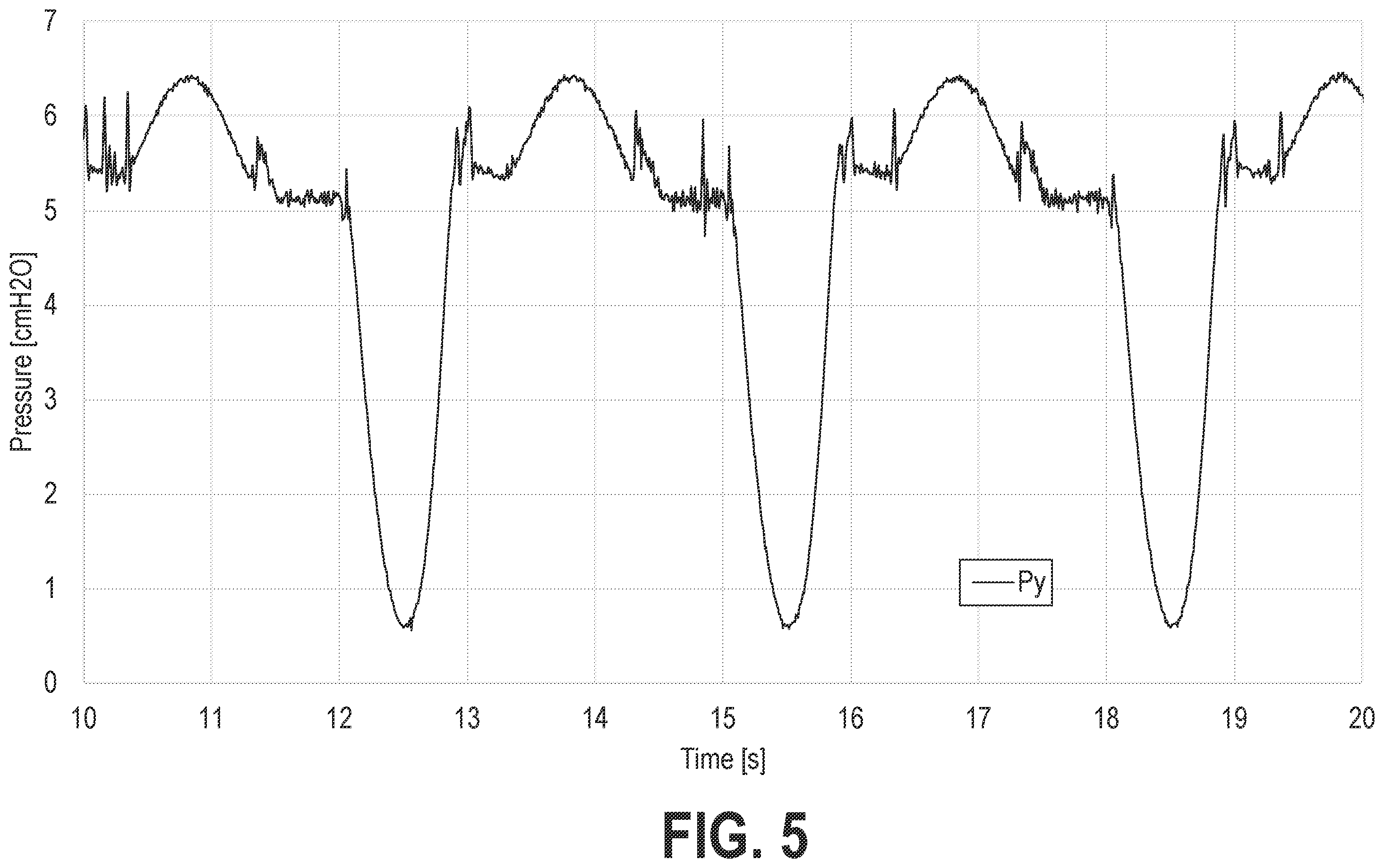 Patent US12569635 Figure 5 – Systems and methods for controlling pressure support devices