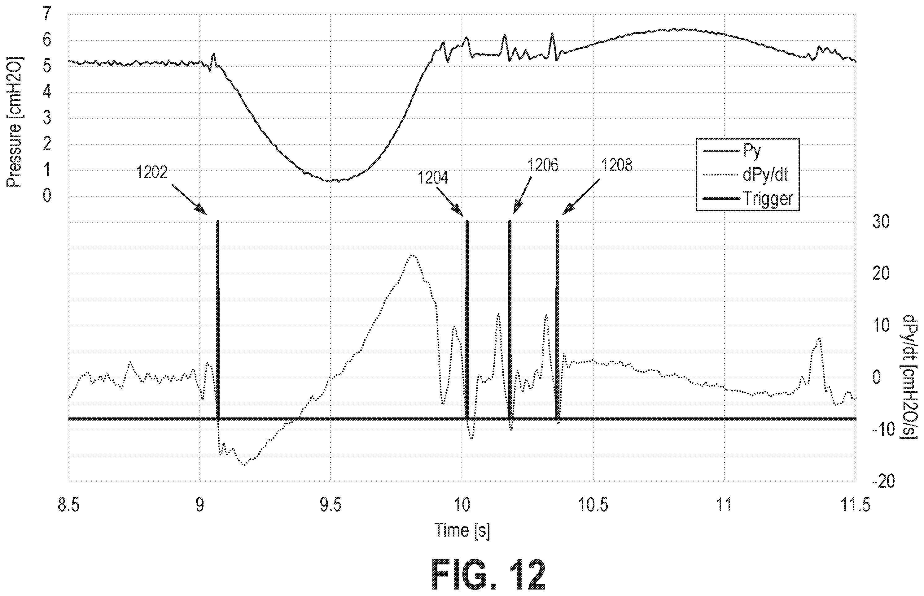 Patent US12569635 Figure 12 – Systems and methods for controlling pressure support devices