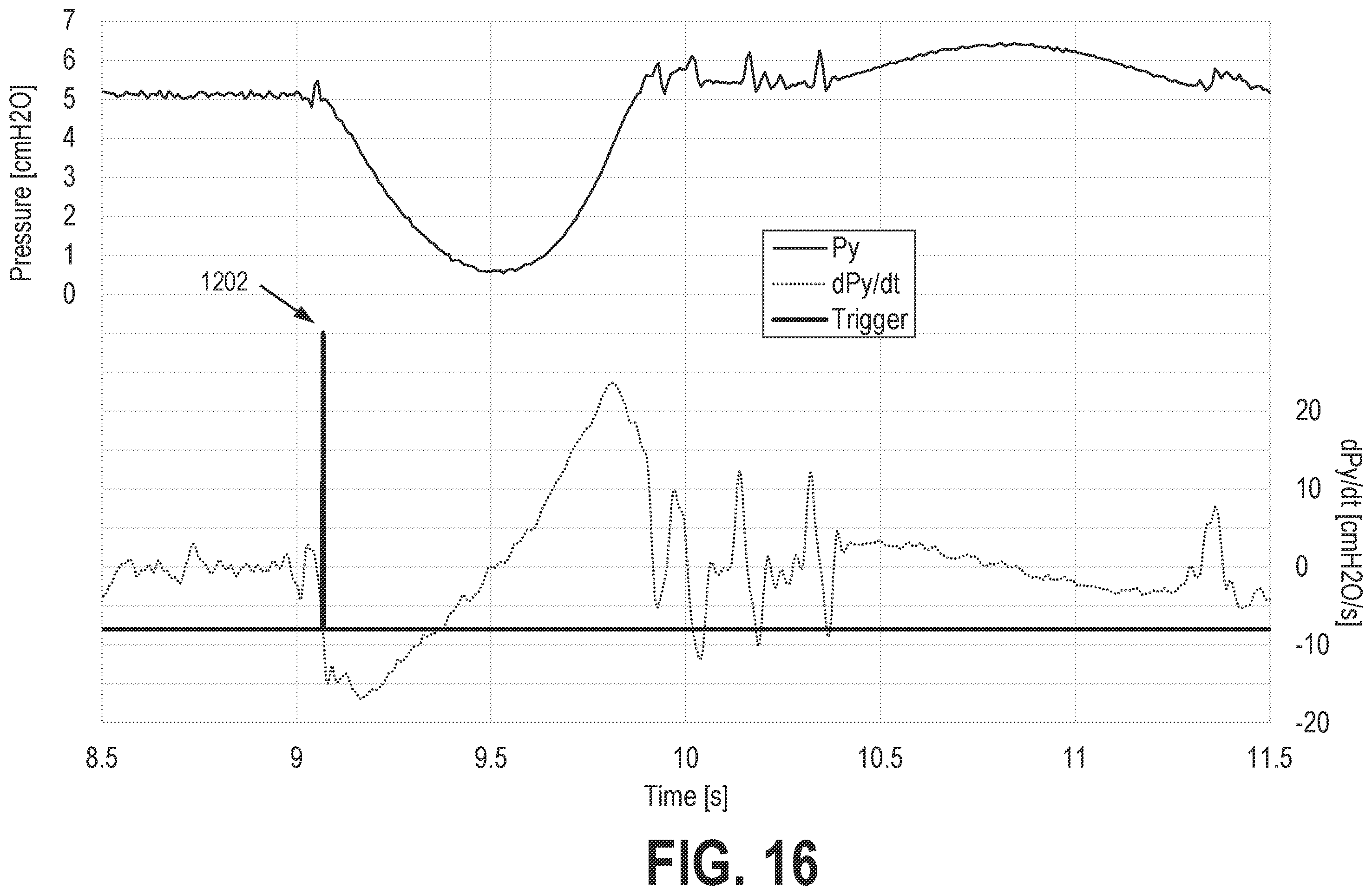 Patent US12569635 Figure 16 – Systems and methods for controlling pressure support devices