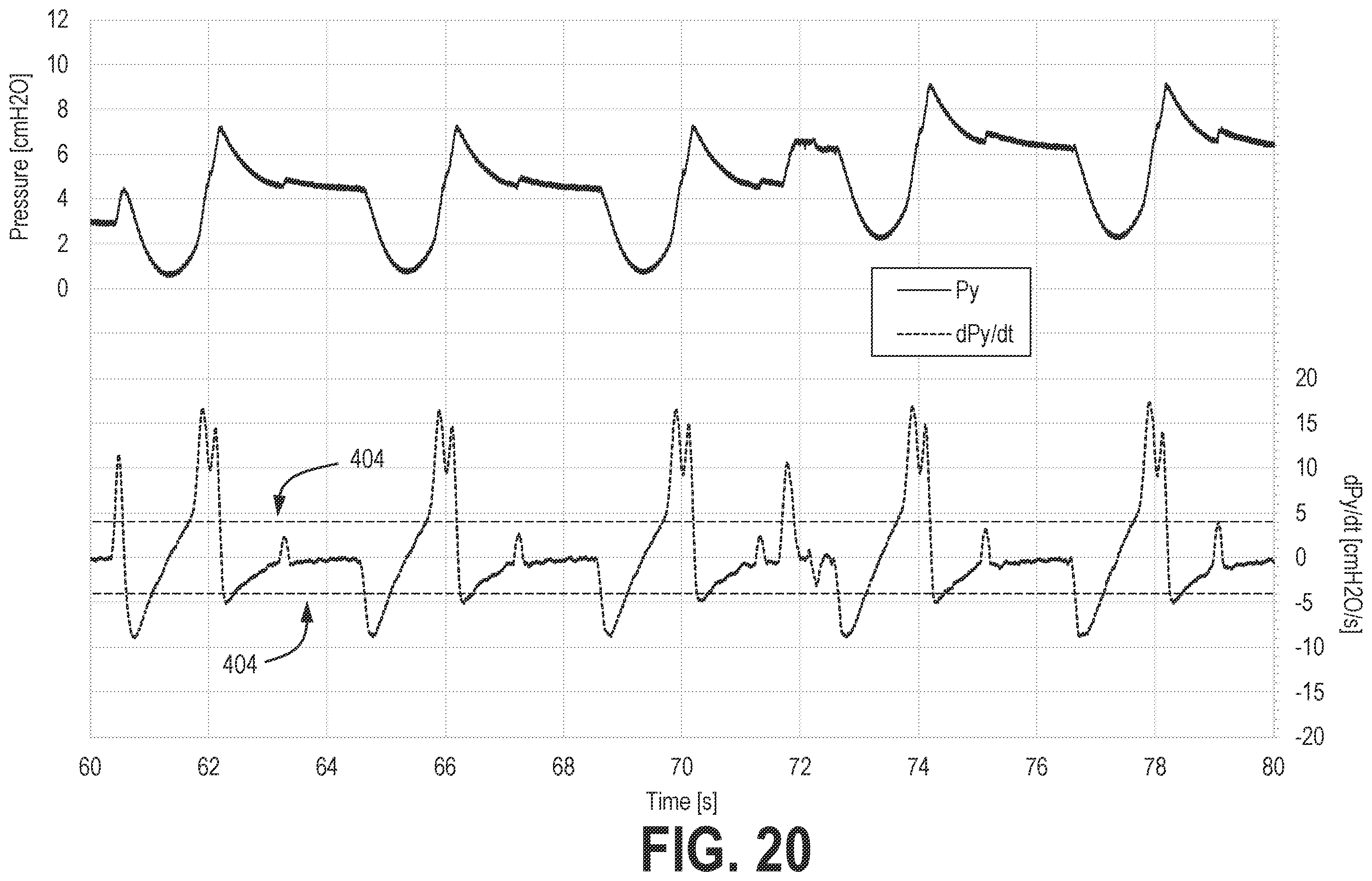 Patent US12569635 Figure 20 – Systems and methods for controlling pressure support devices