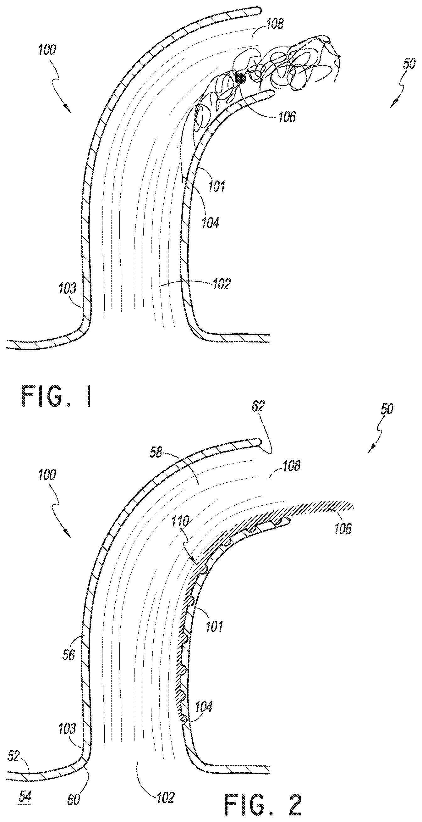 Patent US12569636 — Nasal cannula with turbulation elements — Figure 1