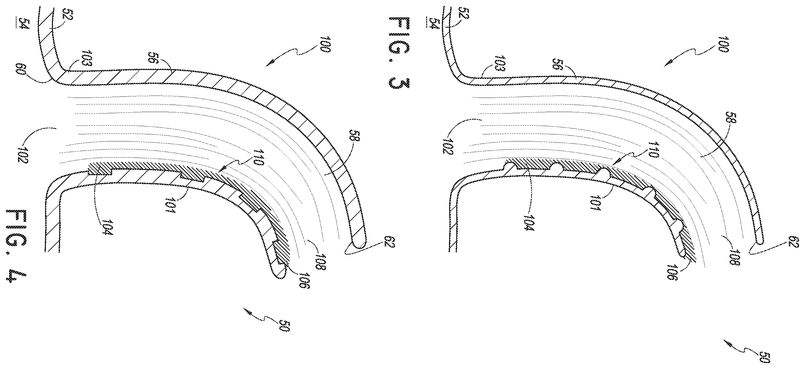 Patent US12569636 Figure 2 – Nasal cannula with turbulation elements
