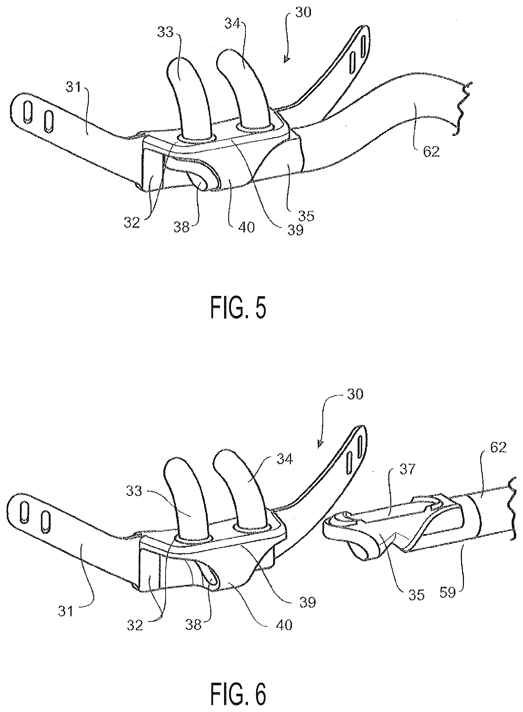 Patent US12569636 Figure 3 – Nasal cannula with turbulation elements