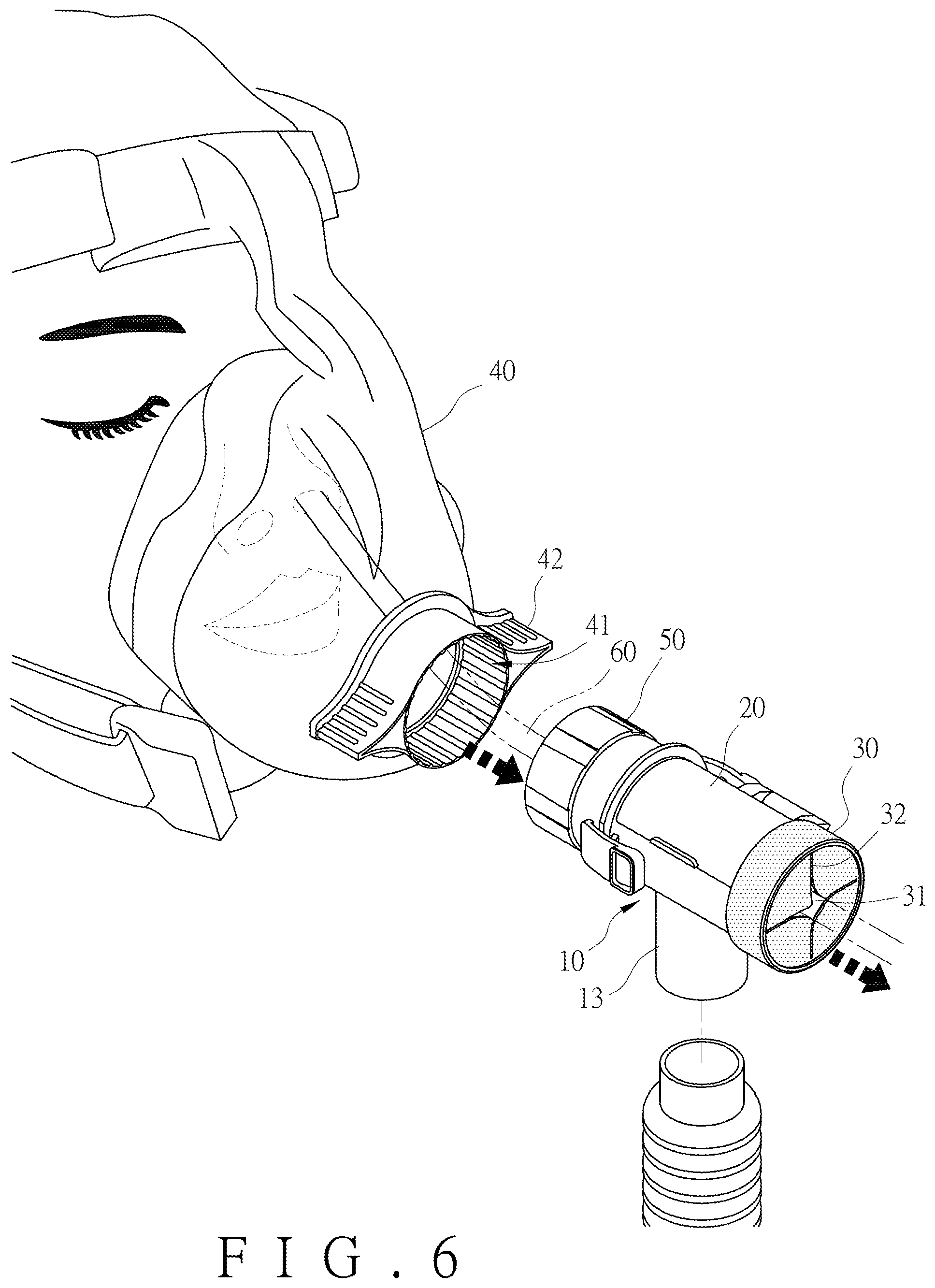 Patent US12569638 Figure 6 – Ventilator mask and joint thereof