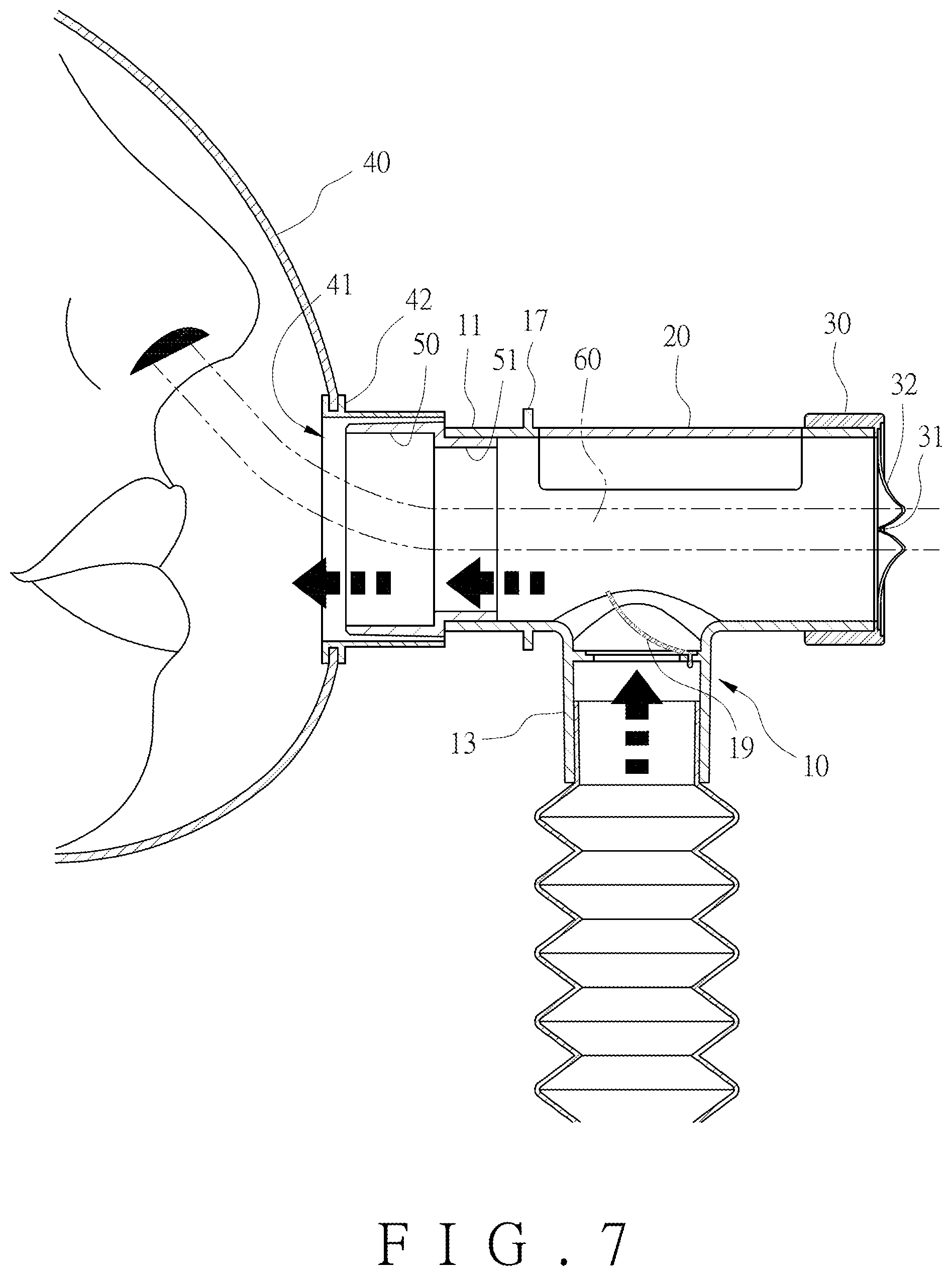 Patent US12569638 Figure 7 – Ventilator mask and joint thereof