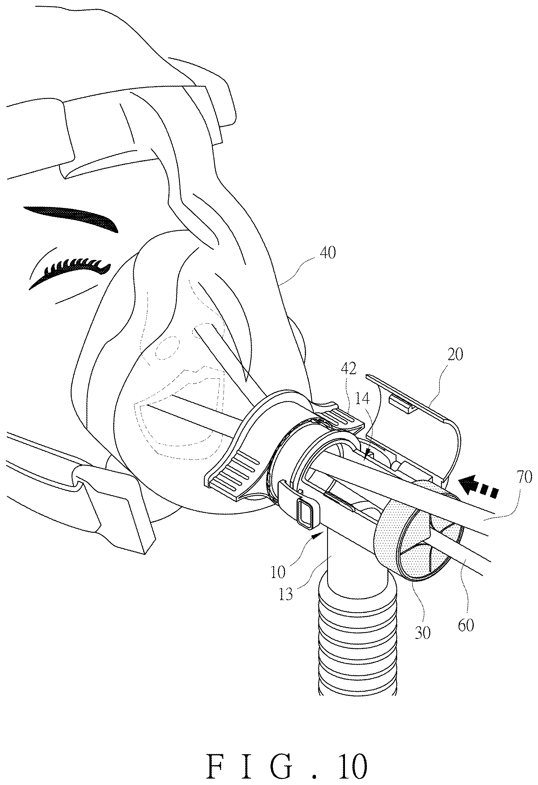 Patent US12569638 Figure 10 – Ventilator mask and joint thereof