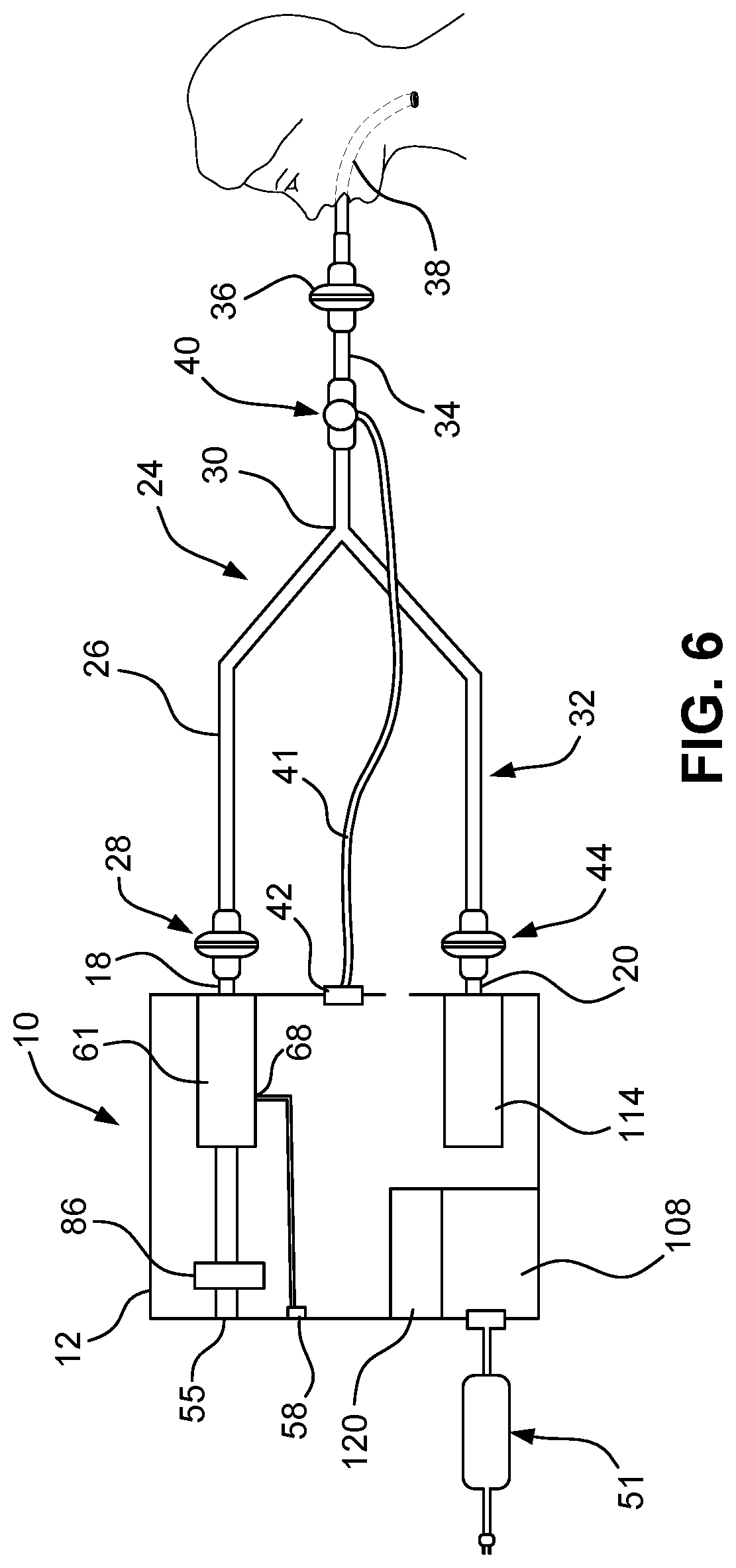 Patent US12569640 Figure 6 – Automated ventilator