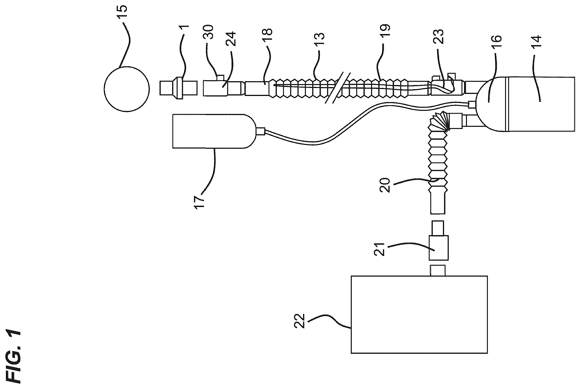 Patent US12569641 Figure 1 – Leakage valve and ventilation tube system