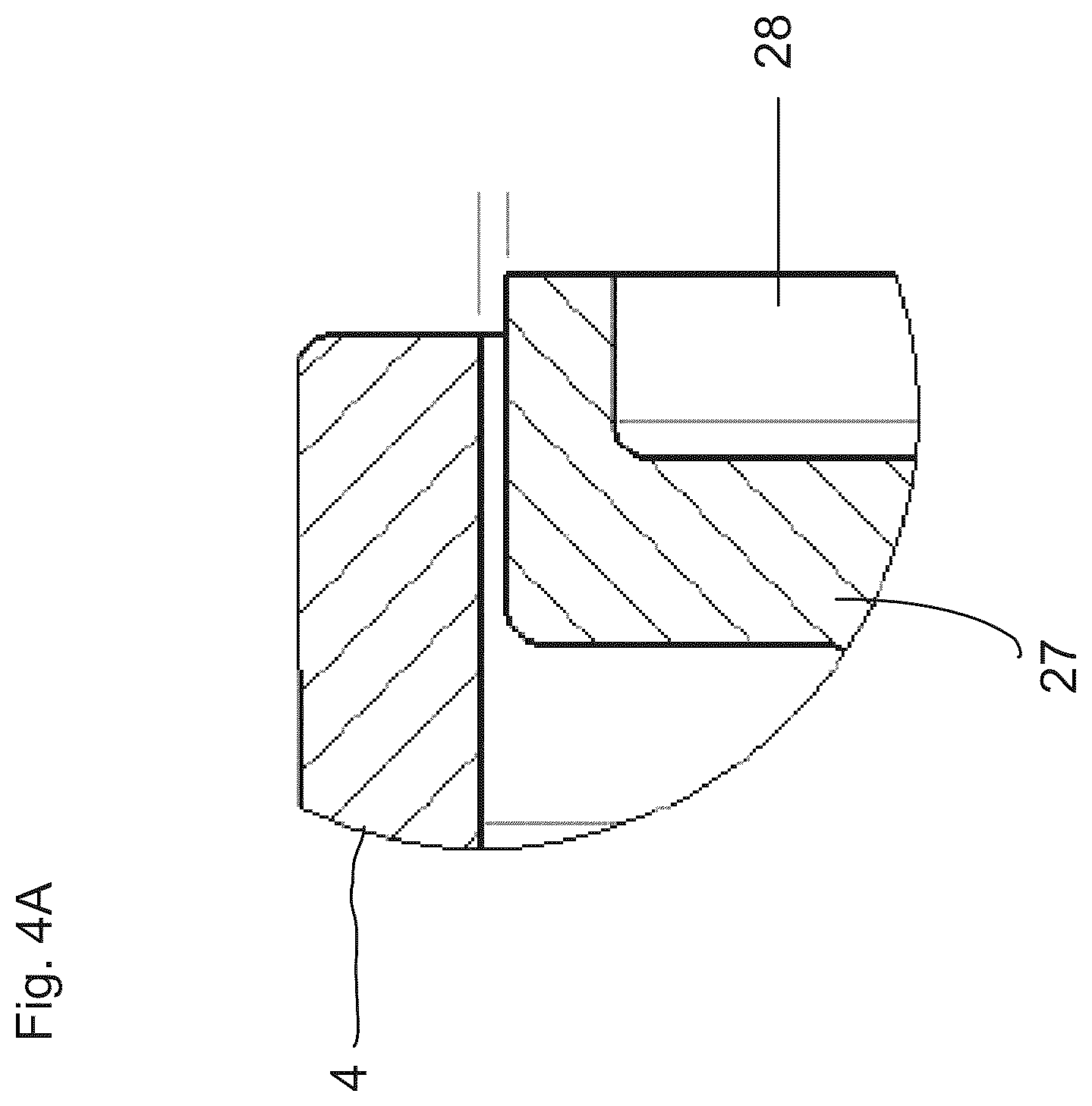 Patent US12569641 Figure 3 – Leakage valve and ventilation tube system