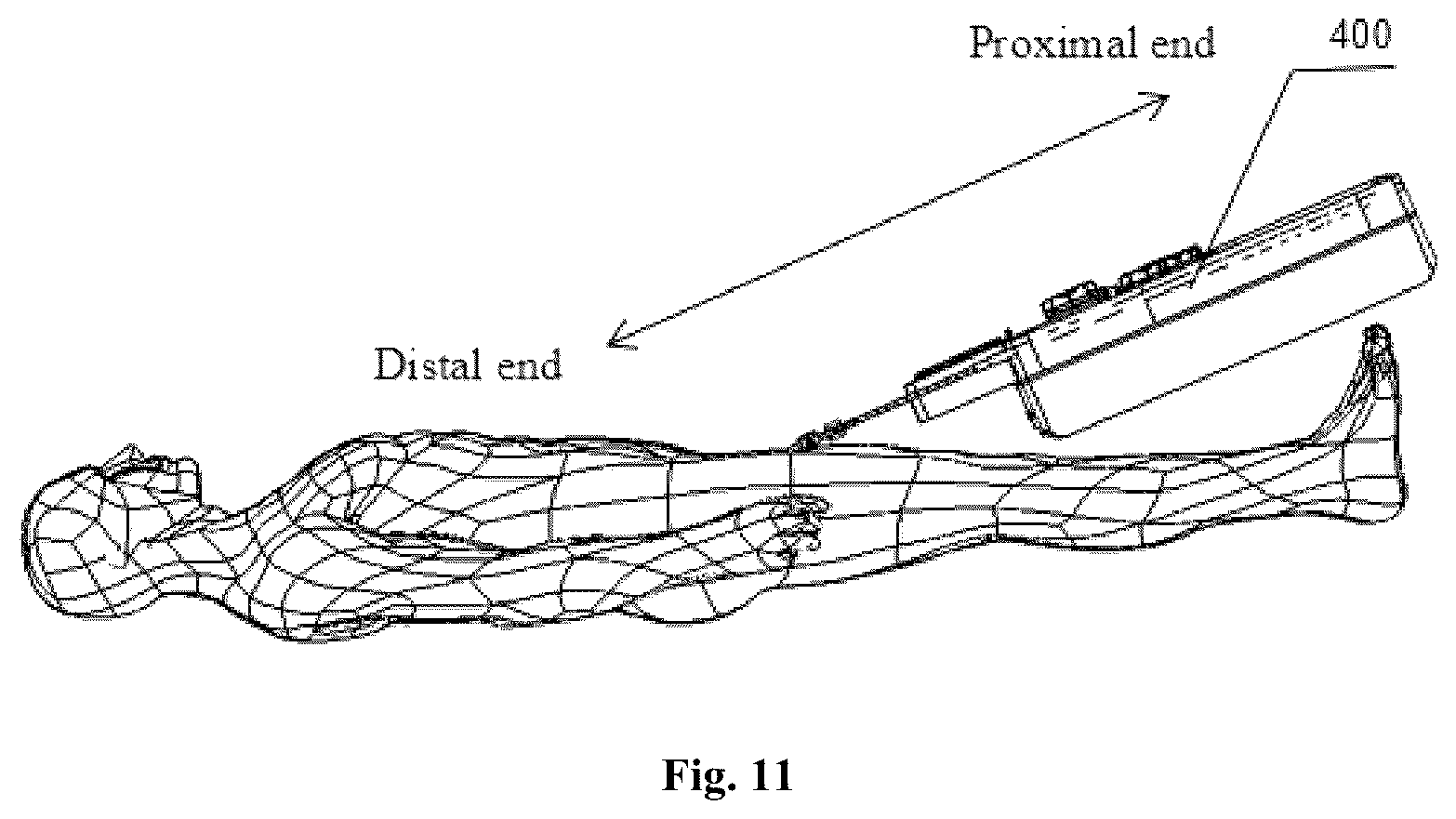 Patent US12569647 Figure 9 – Catheter support apparatus and transluminal intervention system