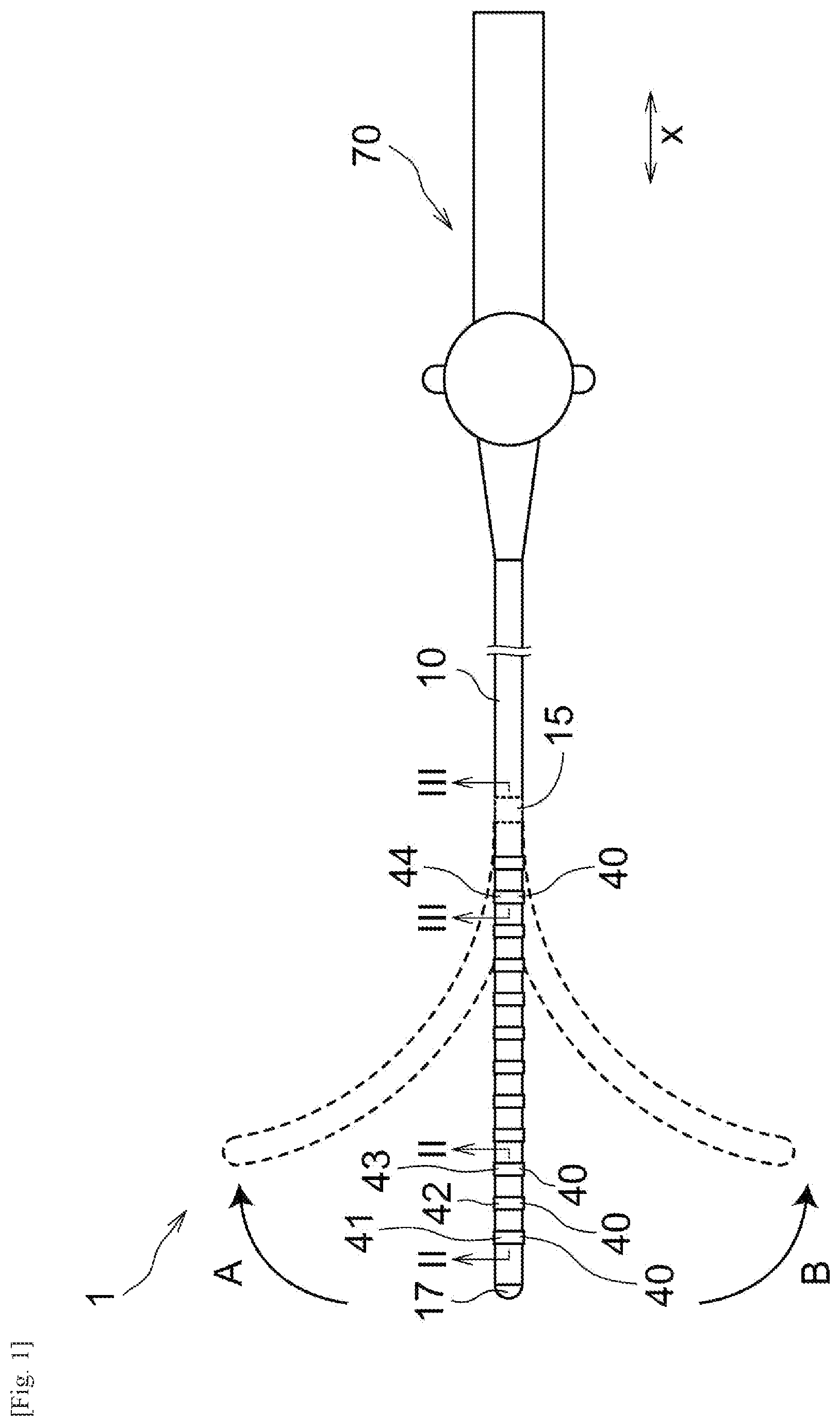 Patent US12569648 Figure 1 – Catheter and method for manufacturing catheter