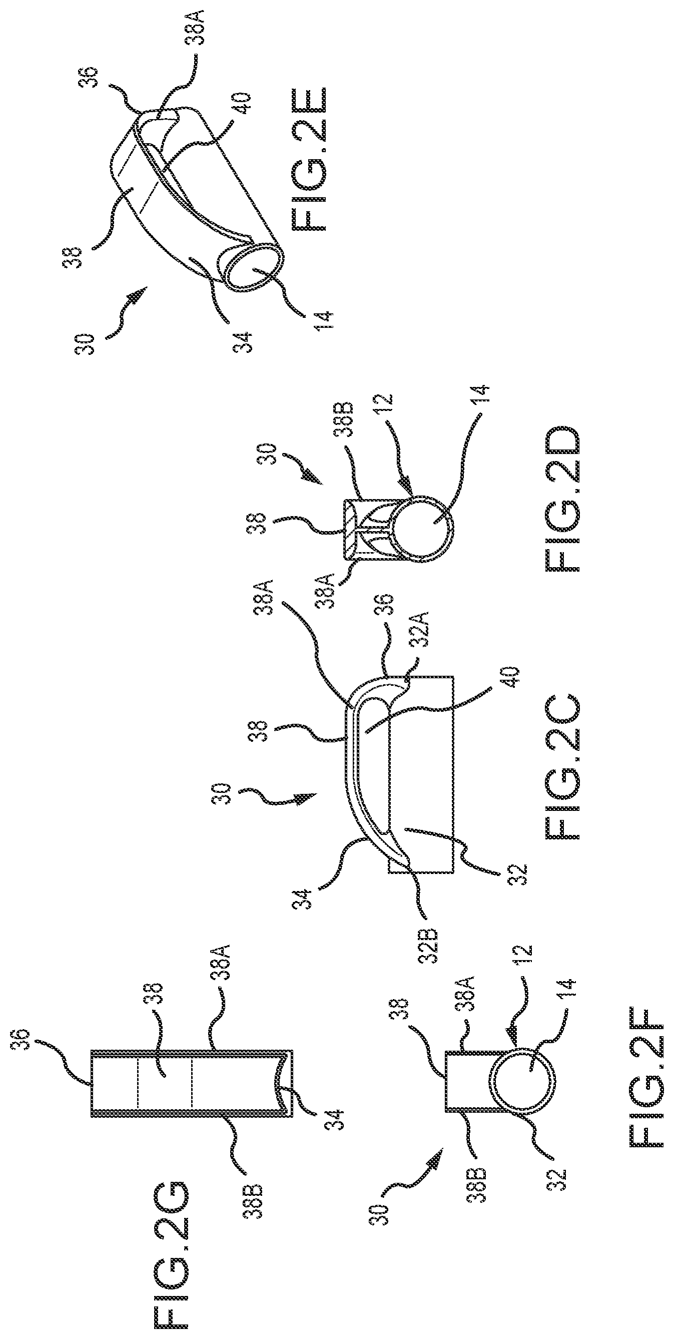 Patent US12569650 Figure 5 – Urinary catheter with retention features