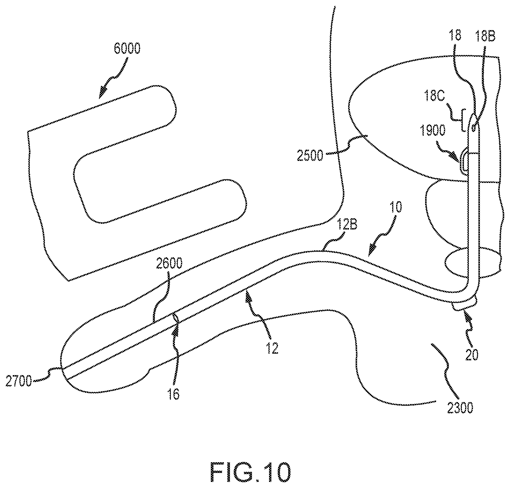 Patent US12569650 Figure 9 – Urinary catheter with retention features