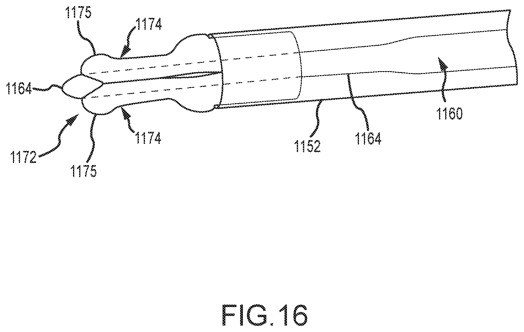 Patent US12569650 Figure 15 – Urinary catheter with retention features