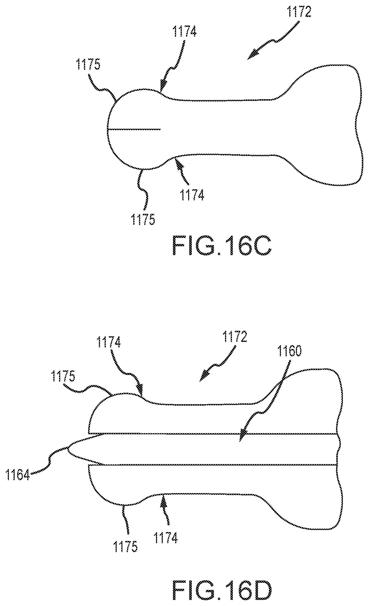 Patent US12569650 Figure 17 – Urinary catheter with retention features