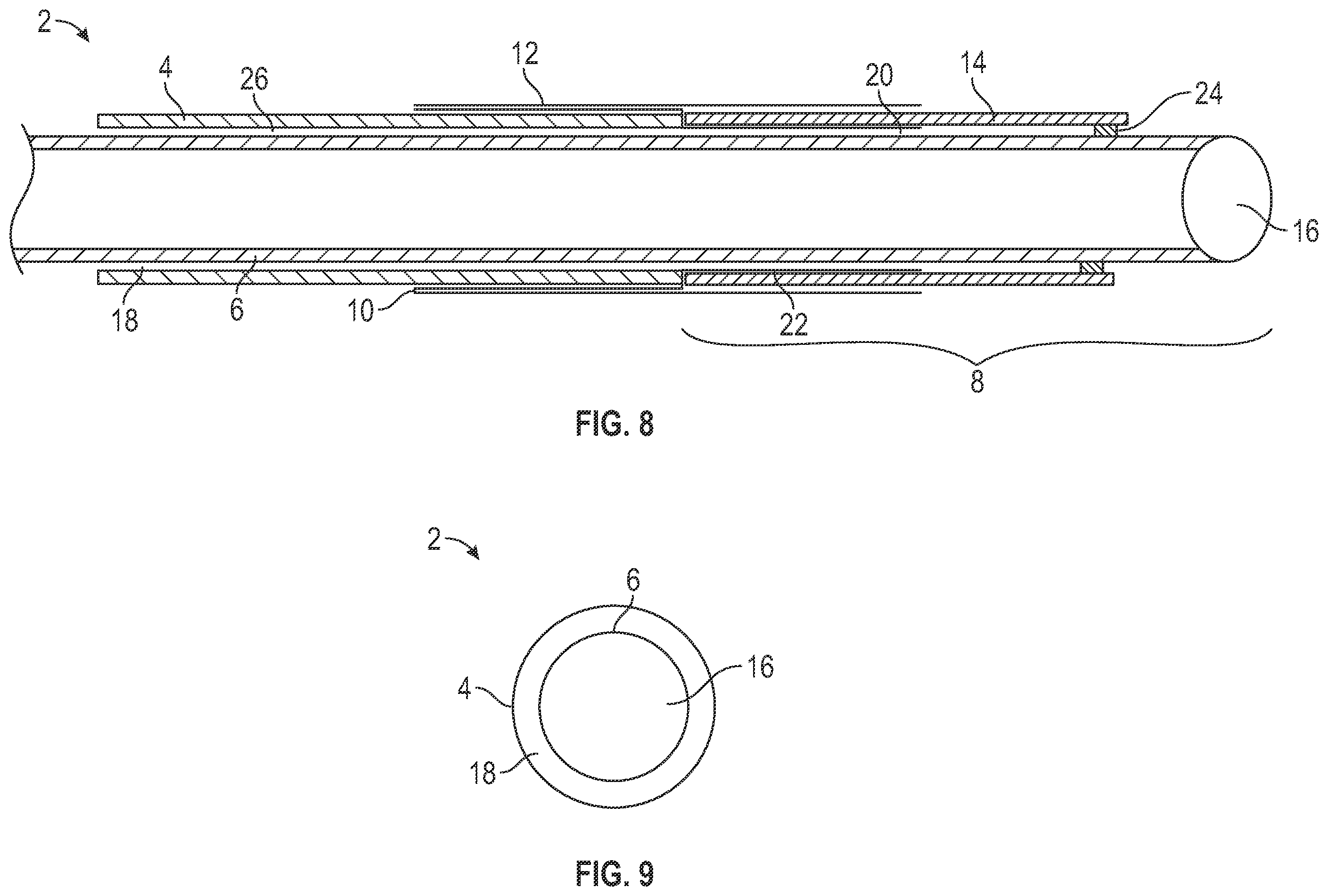 Patent US12569653 Figure 6 – Balloon catheters and methods of manufacture and use