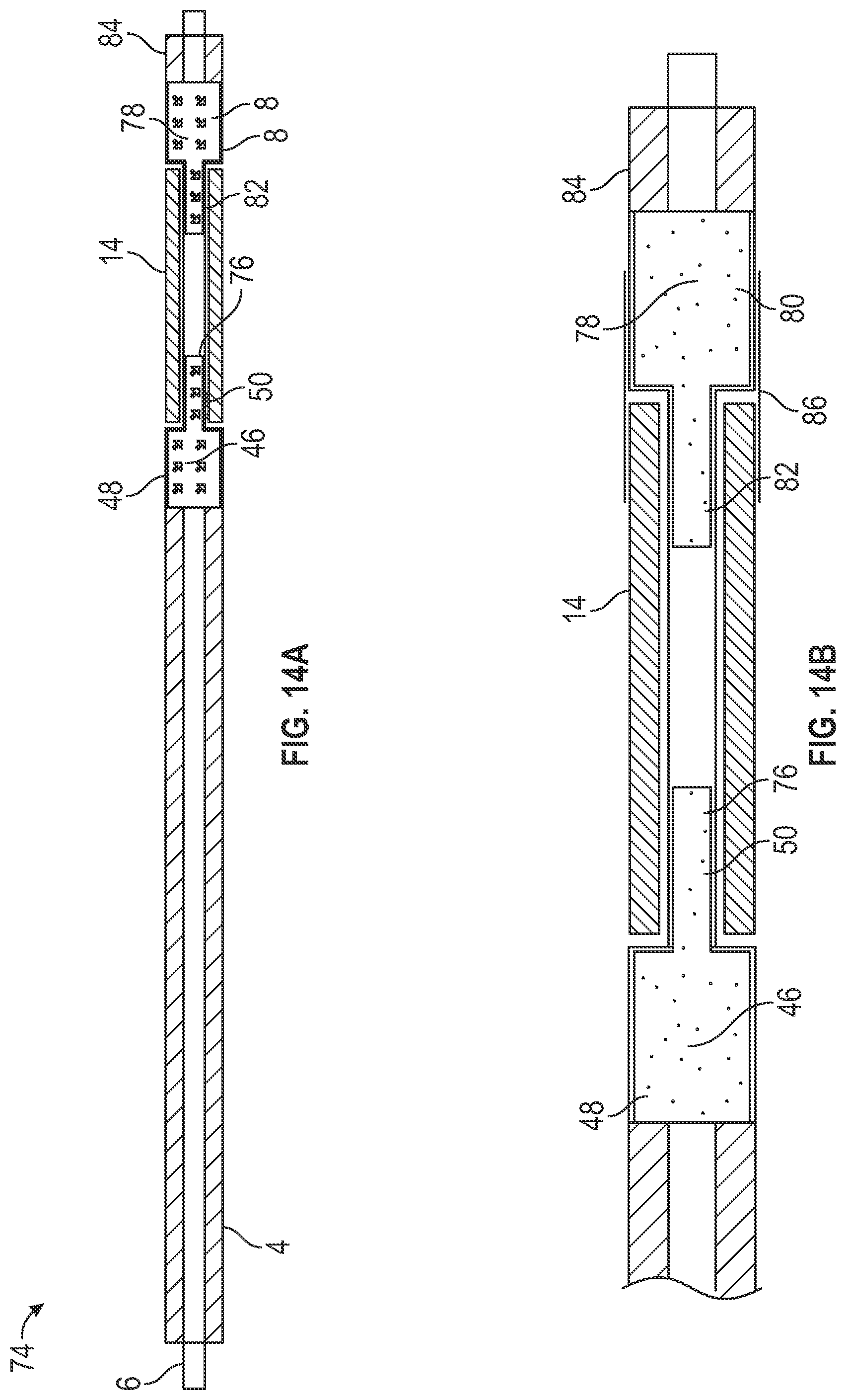 Patent US12569653 Figure 10 – Balloon catheters and methods of manufacture and use