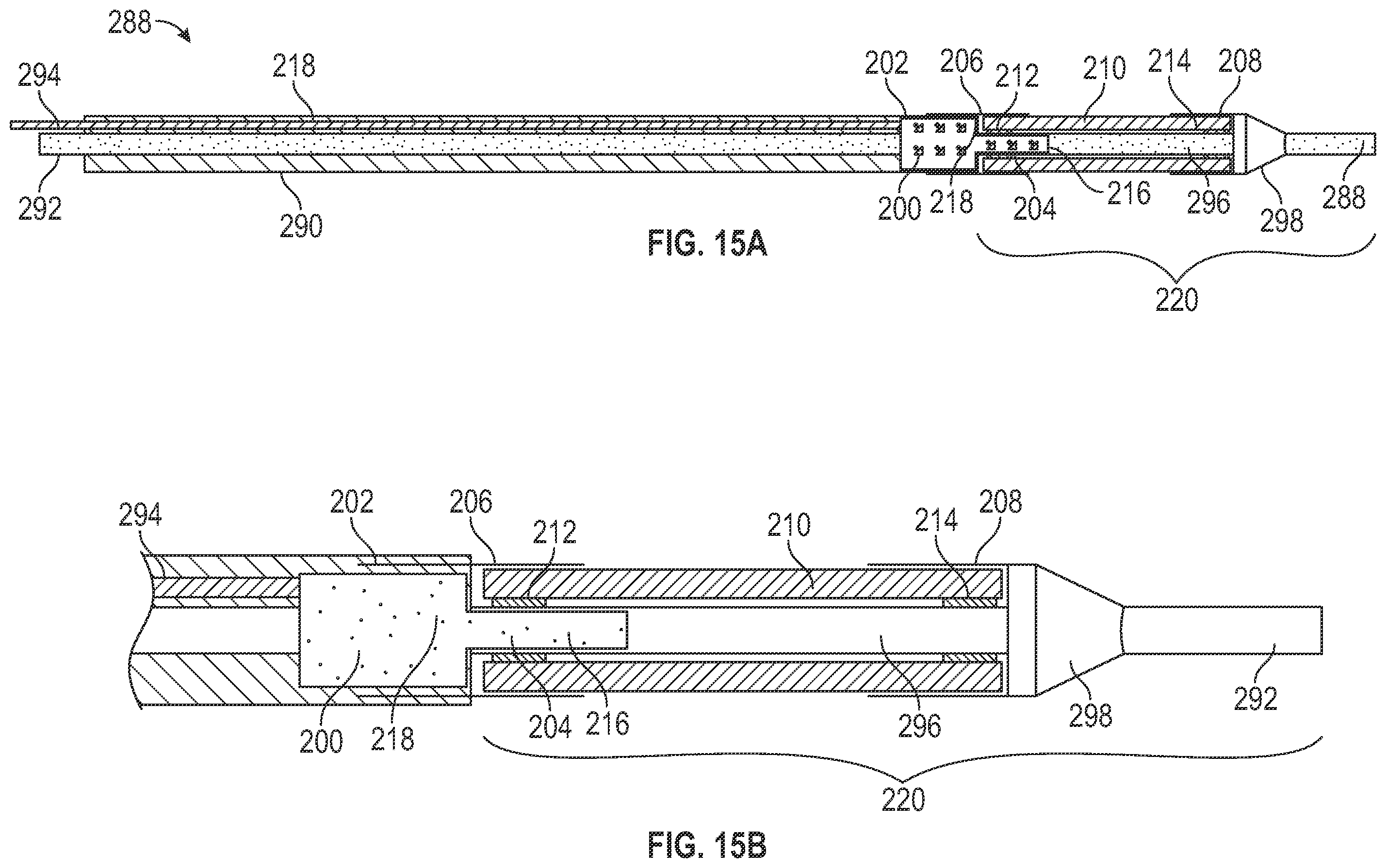 Patent US12569653 Figure 11 – Balloon catheters and methods of manufacture and use