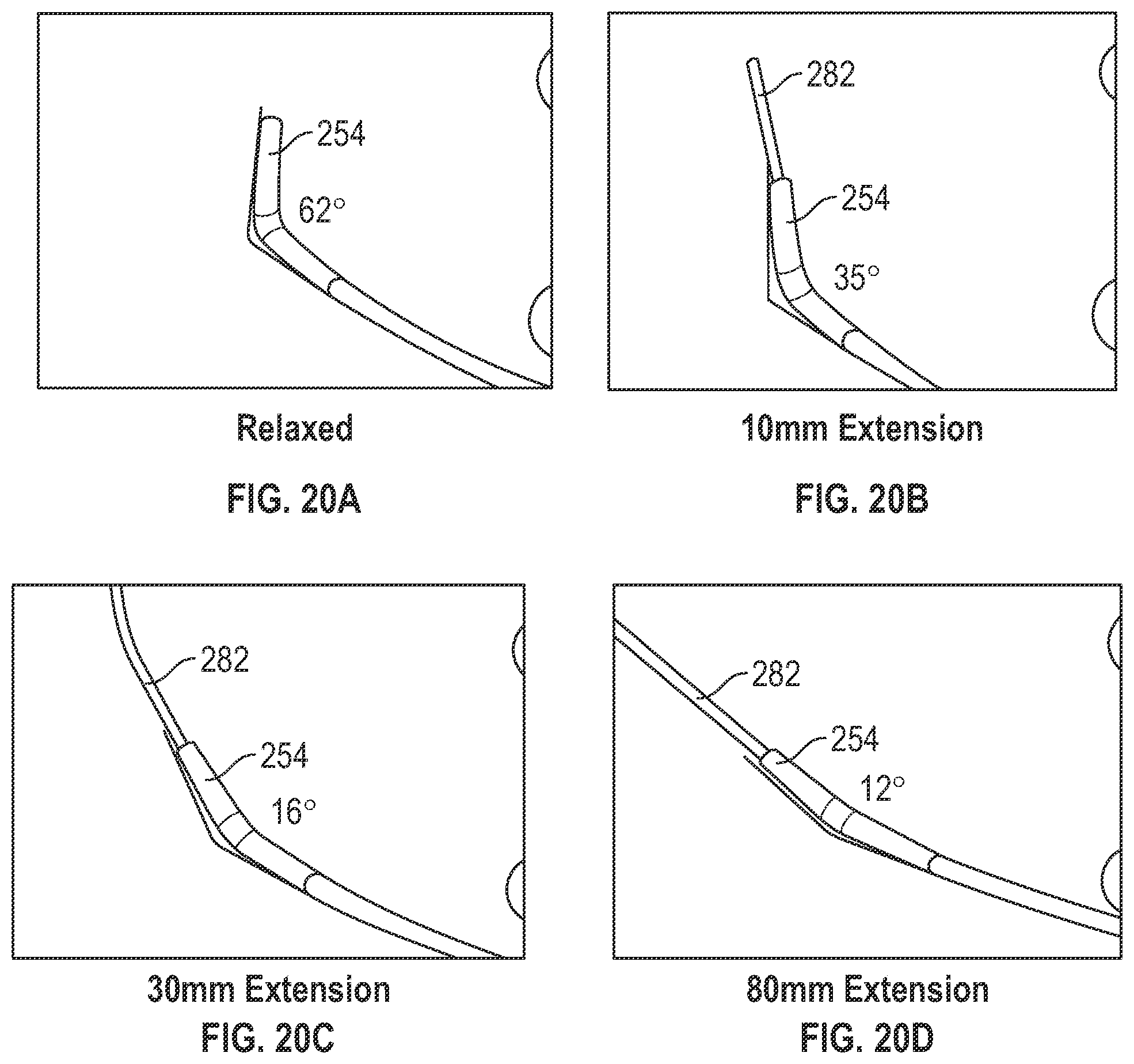 Patent US12569653 Figure 15 – Balloon catheters and methods of manufacture and use
