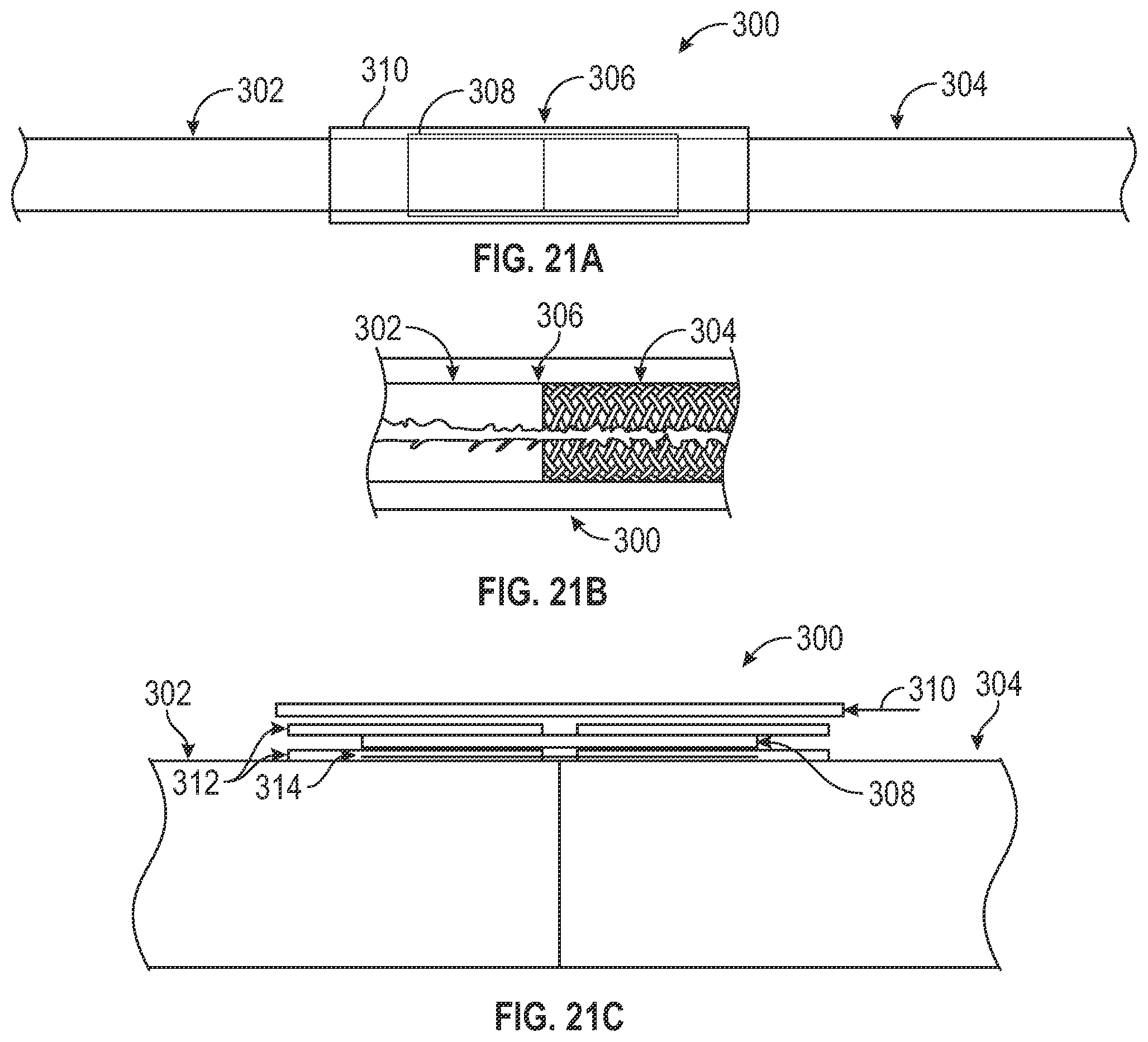 Patent US12569653 Figure 16 – Balloon catheters and methods of manufacture and use